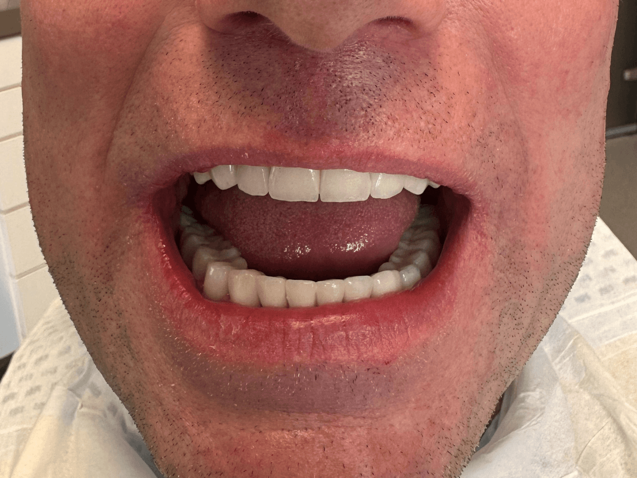 After dental treatment