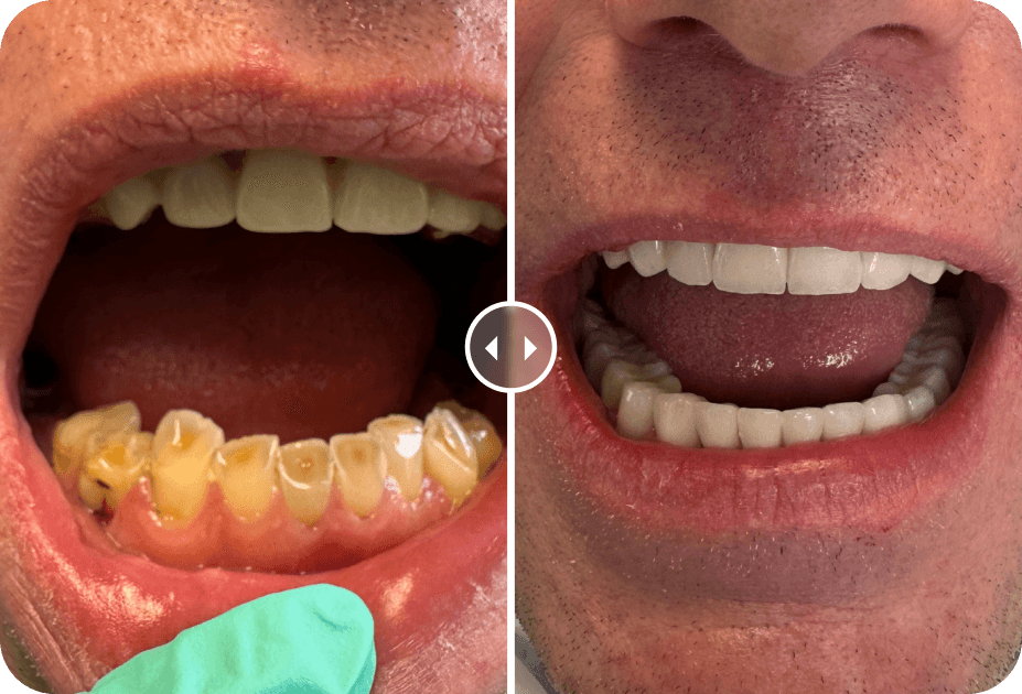 Dental Treatment Before and After