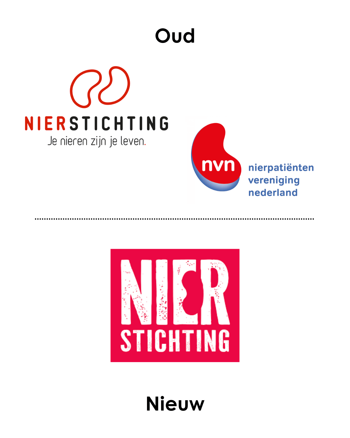 Nierstichting & NVN โ Nierstichting Nierstichting & NVN โ Nierstichting