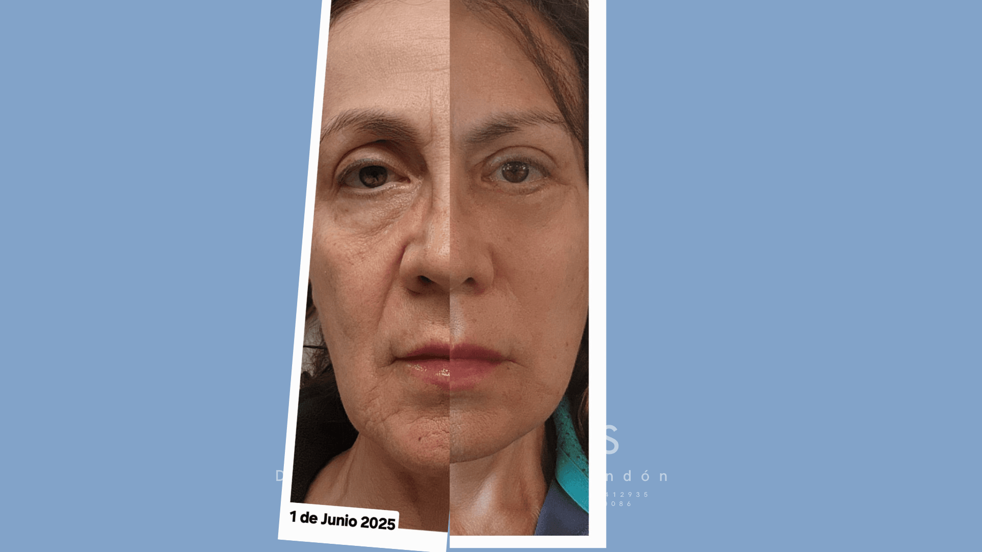 facial surgery facial surgery