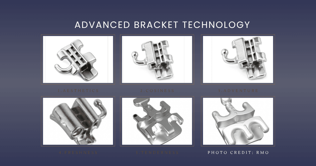 braces comparison braces comparison