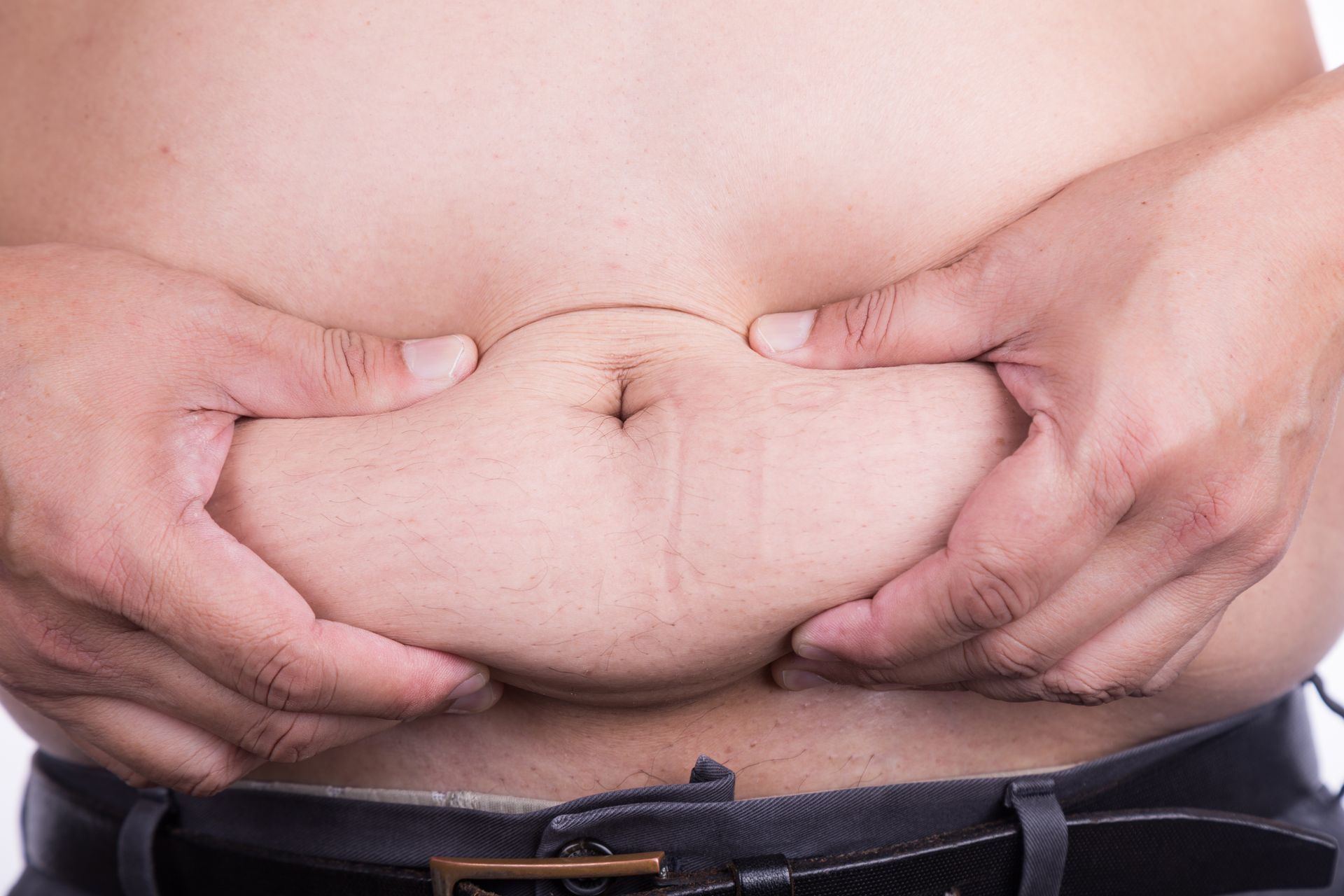Fotografía de la panza de un hombre que desea realizarse la lipoescultura para hombres en PARS Fotografía de la panza de un hombre que desea realizarse la lipoescultura para hombres en PARS