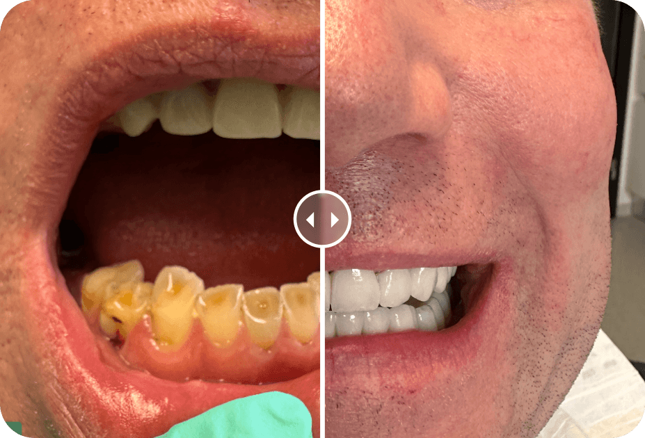 Dental Treatment Before and After