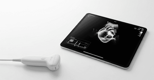 Handheld Point of Care Ultrasound Probe and Tablet