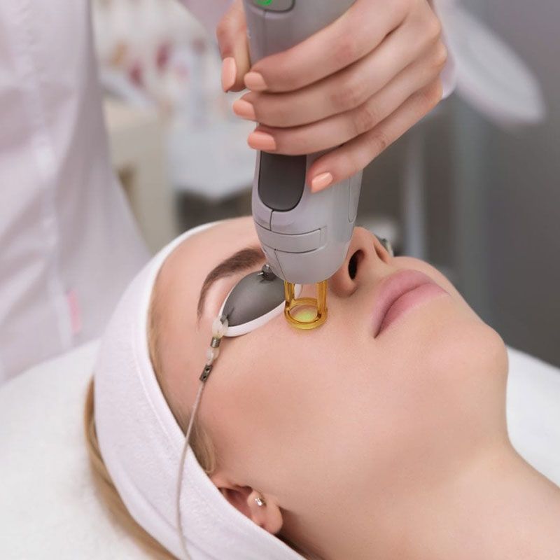 laser skin treatment laser skin treatment