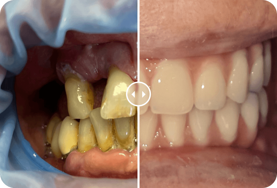 Dental Treatment Before and After