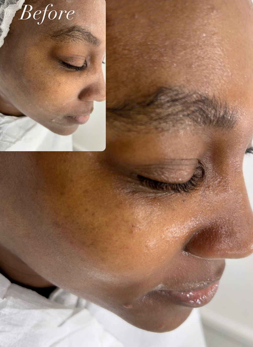 facial treatment facial treatment