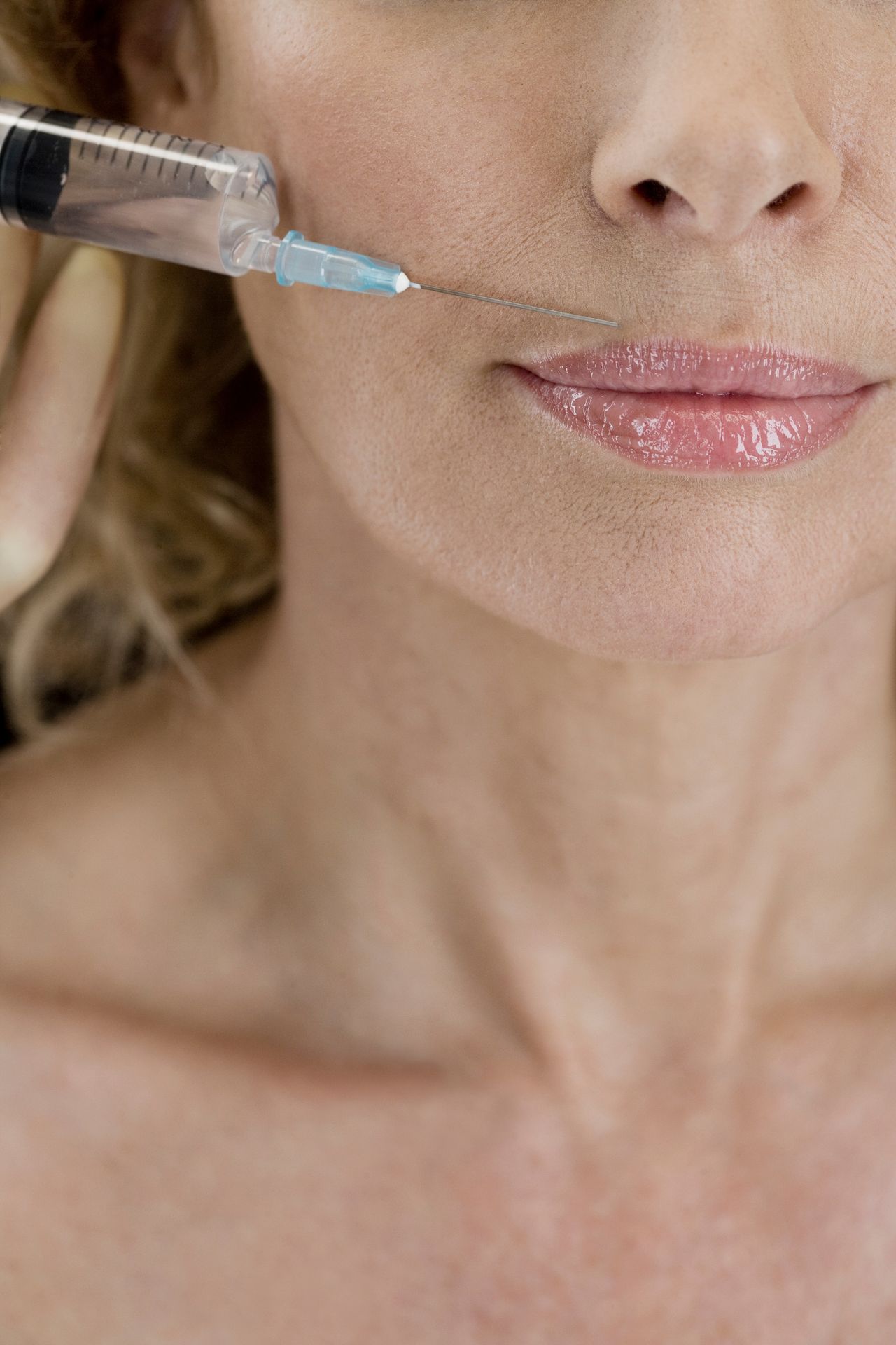 Fotografía de una mujer inyectándose los labios sin cuestionarse si Ácido hialurónico vs cirugía: ¿qué conviene más?