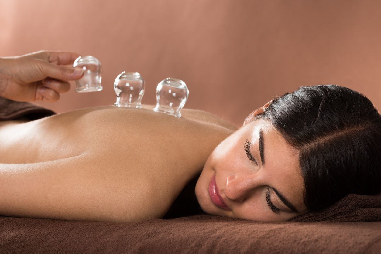 cupping for pain relief 