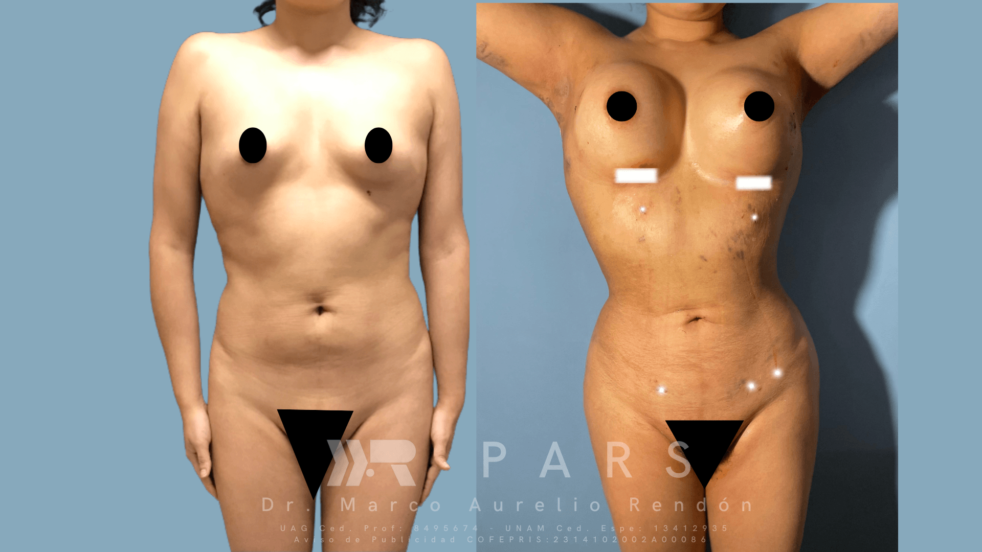 cosmetic surgery consultation cosmetic surgery consultation