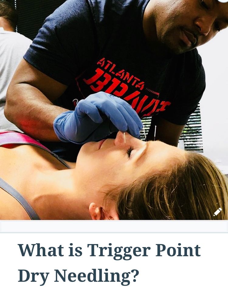 What is Trigger Point Dry Needling?