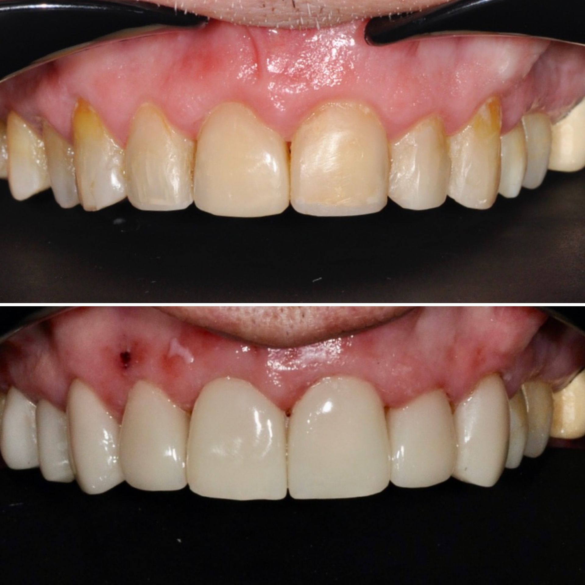 Smile Transformations / Patient Cases