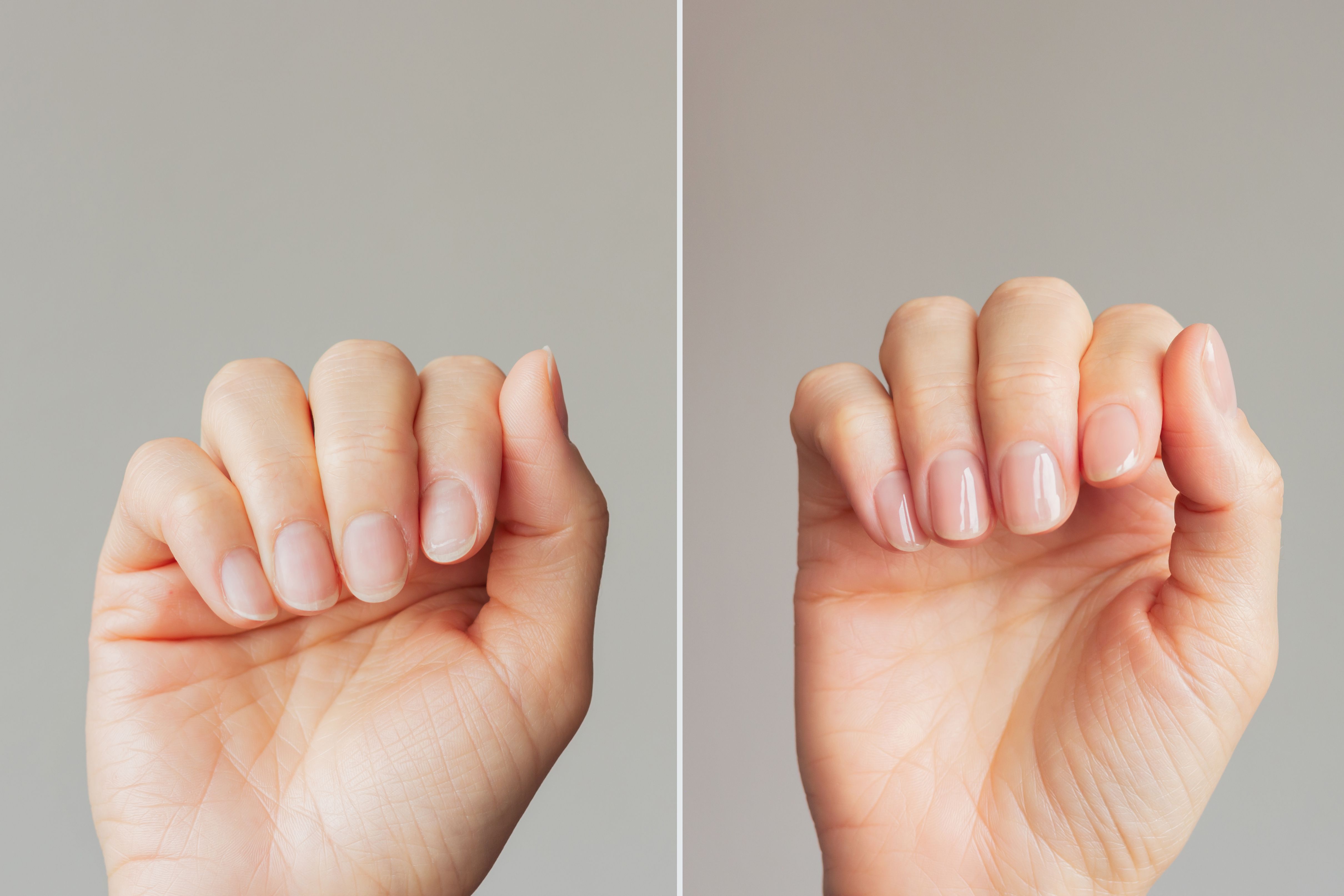 nail comparison