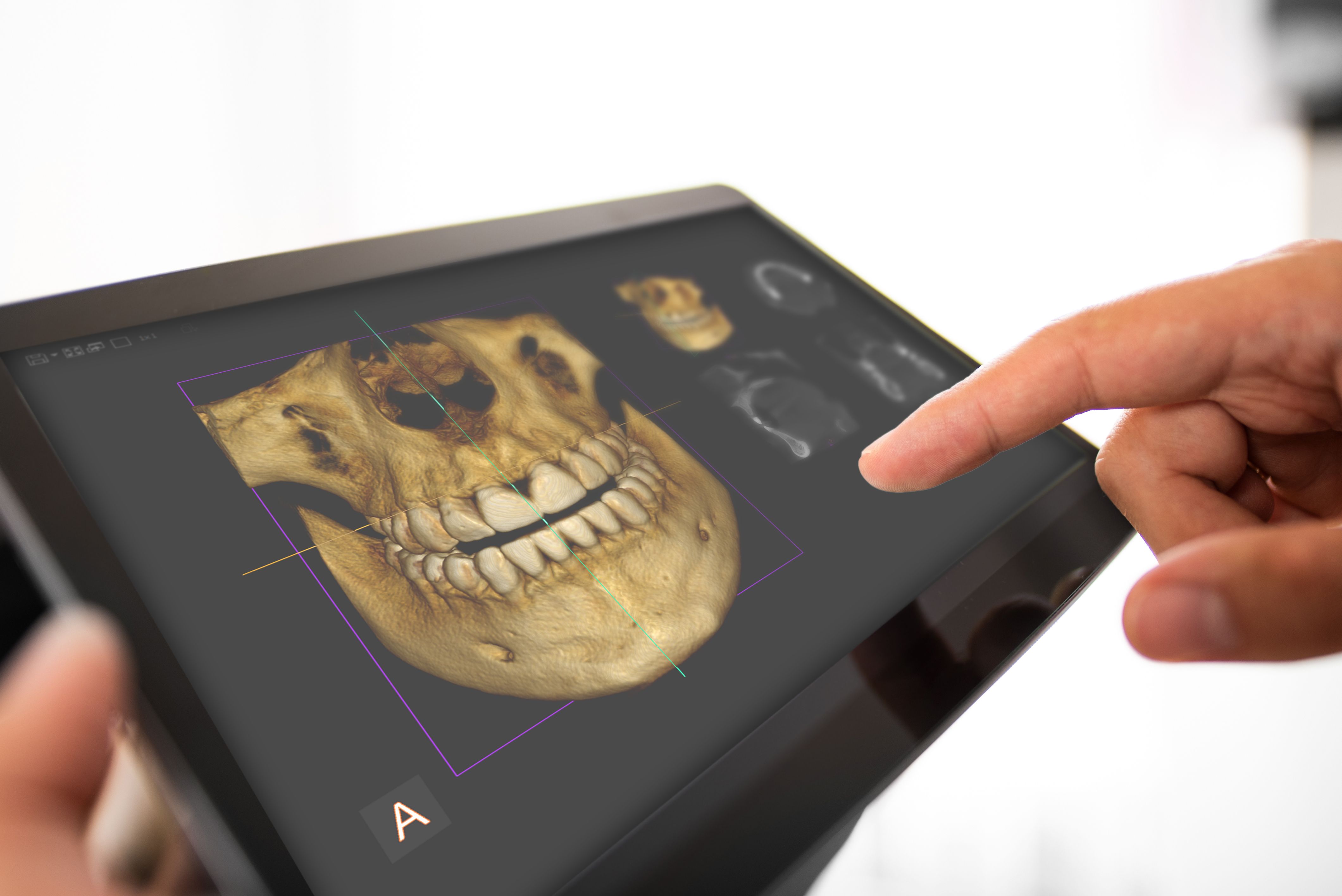 3d imaging