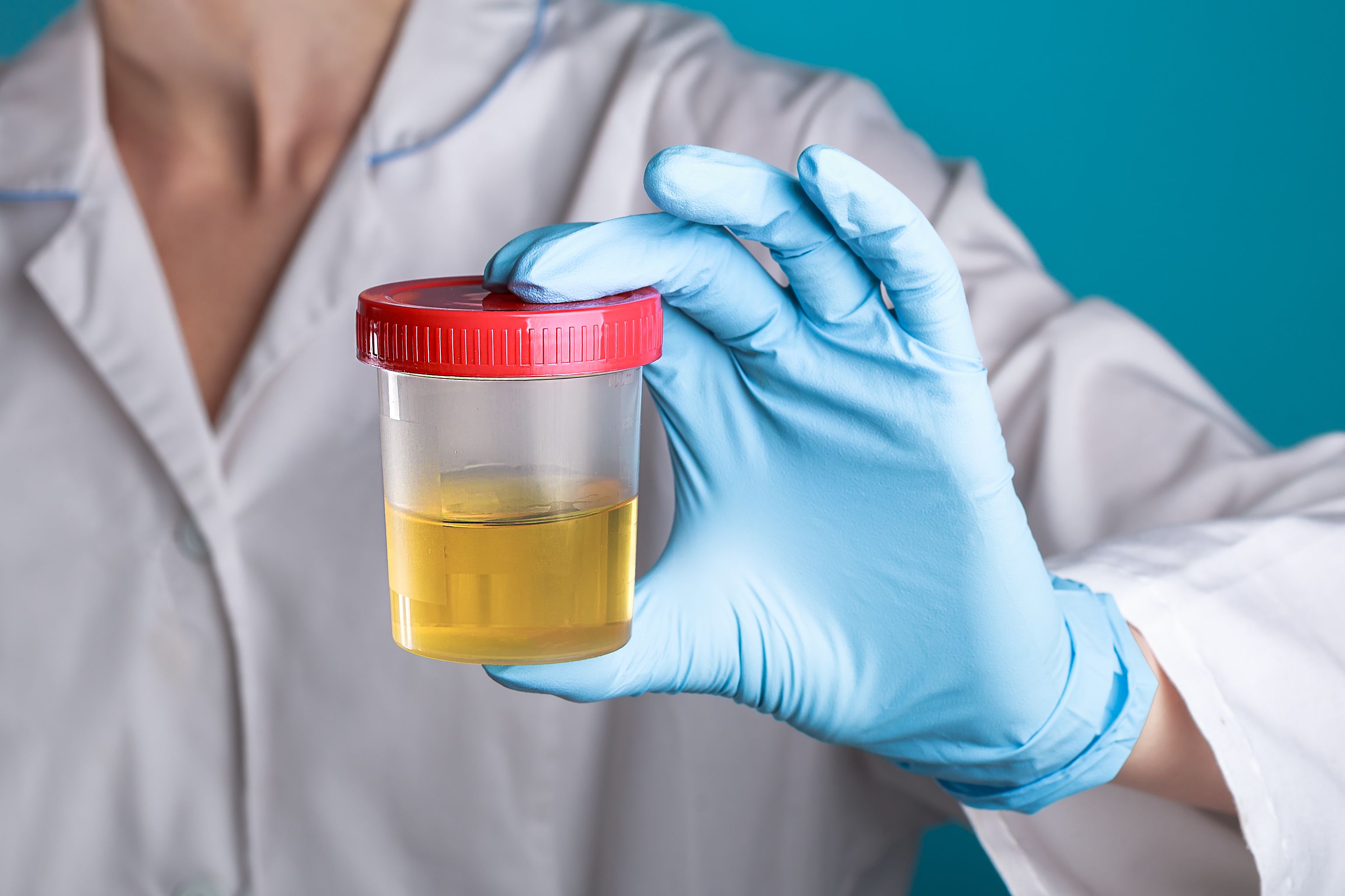 urine test
