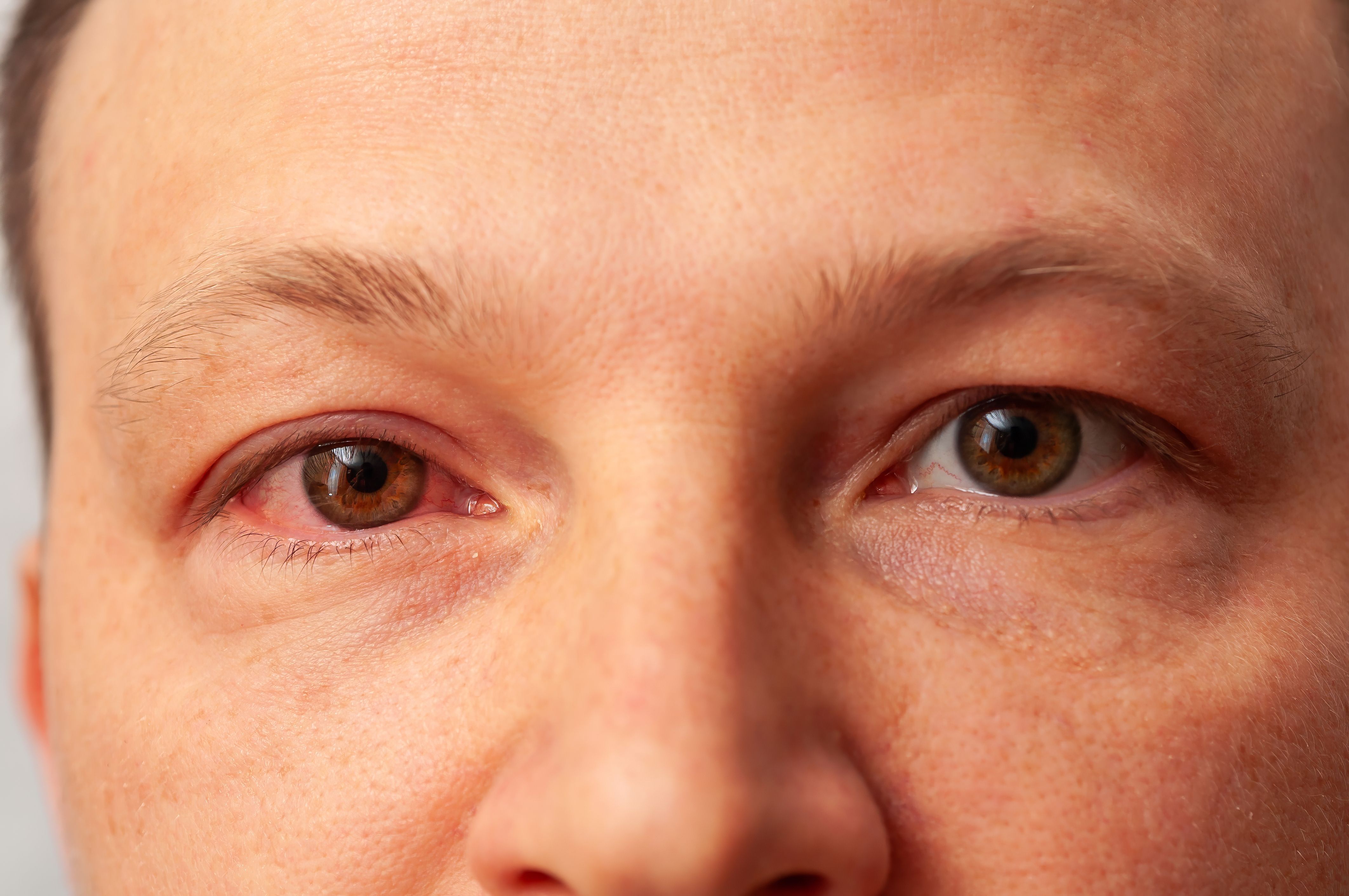 eyebrow consultation