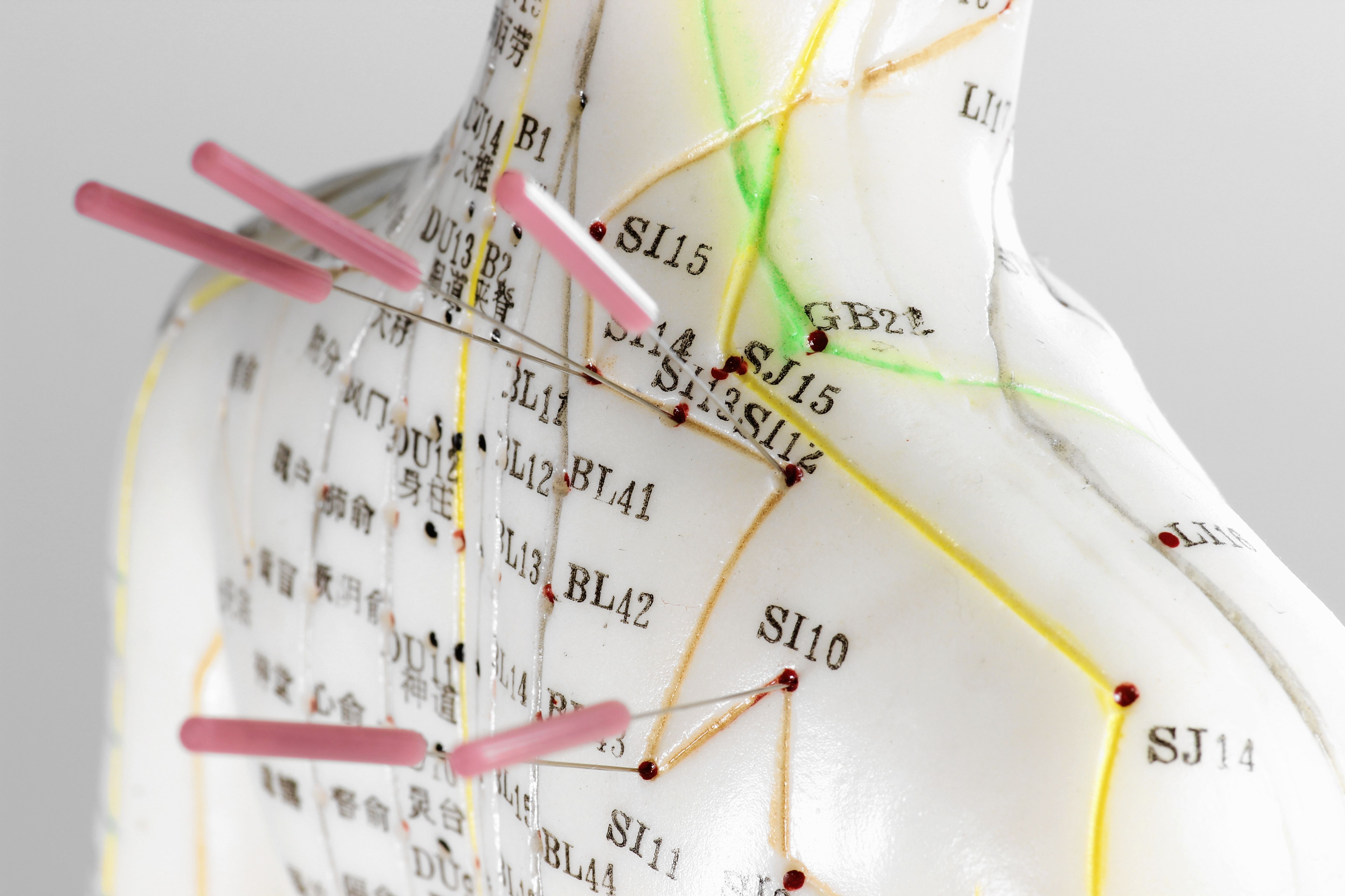 acupuncture immunity