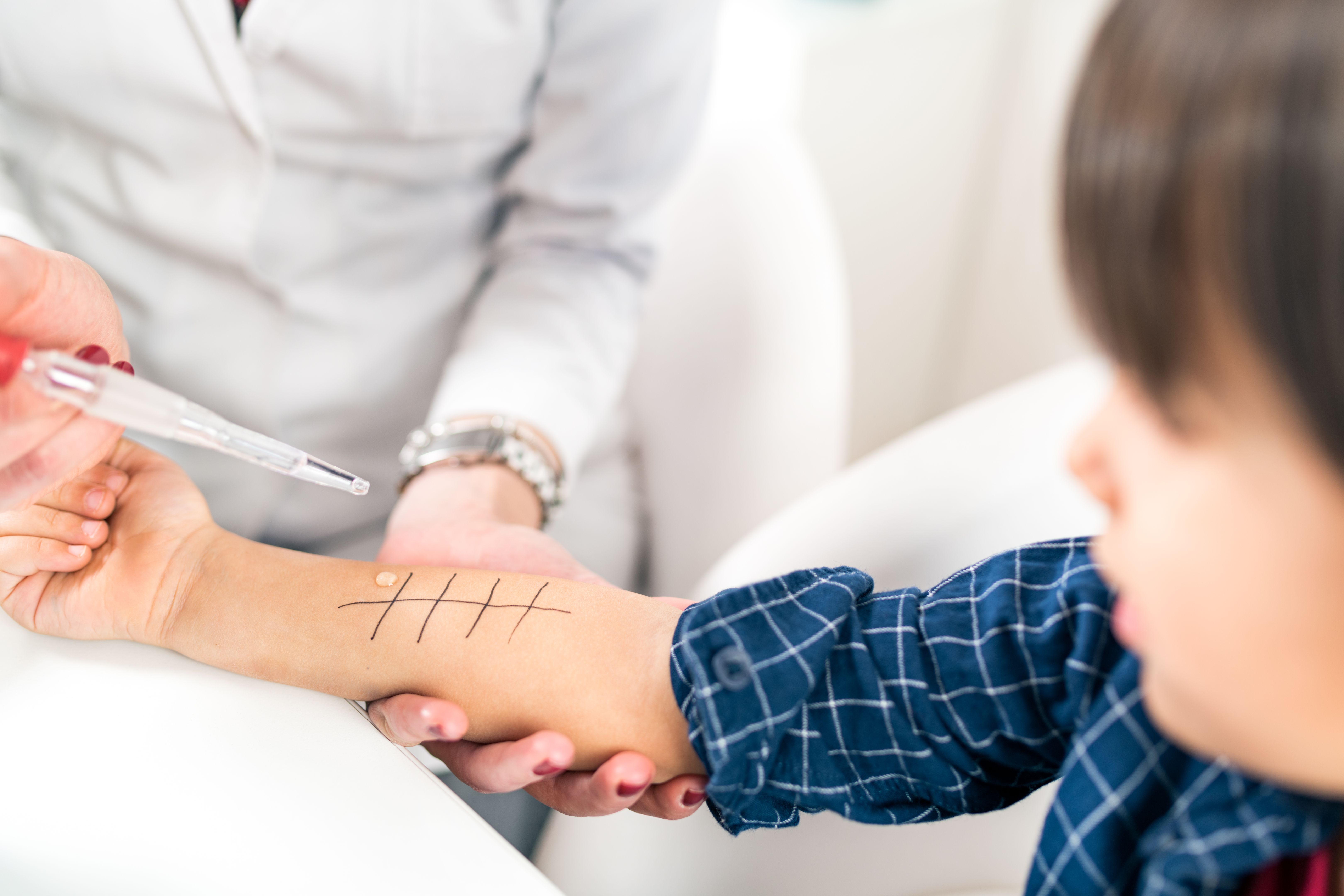 allergy test
