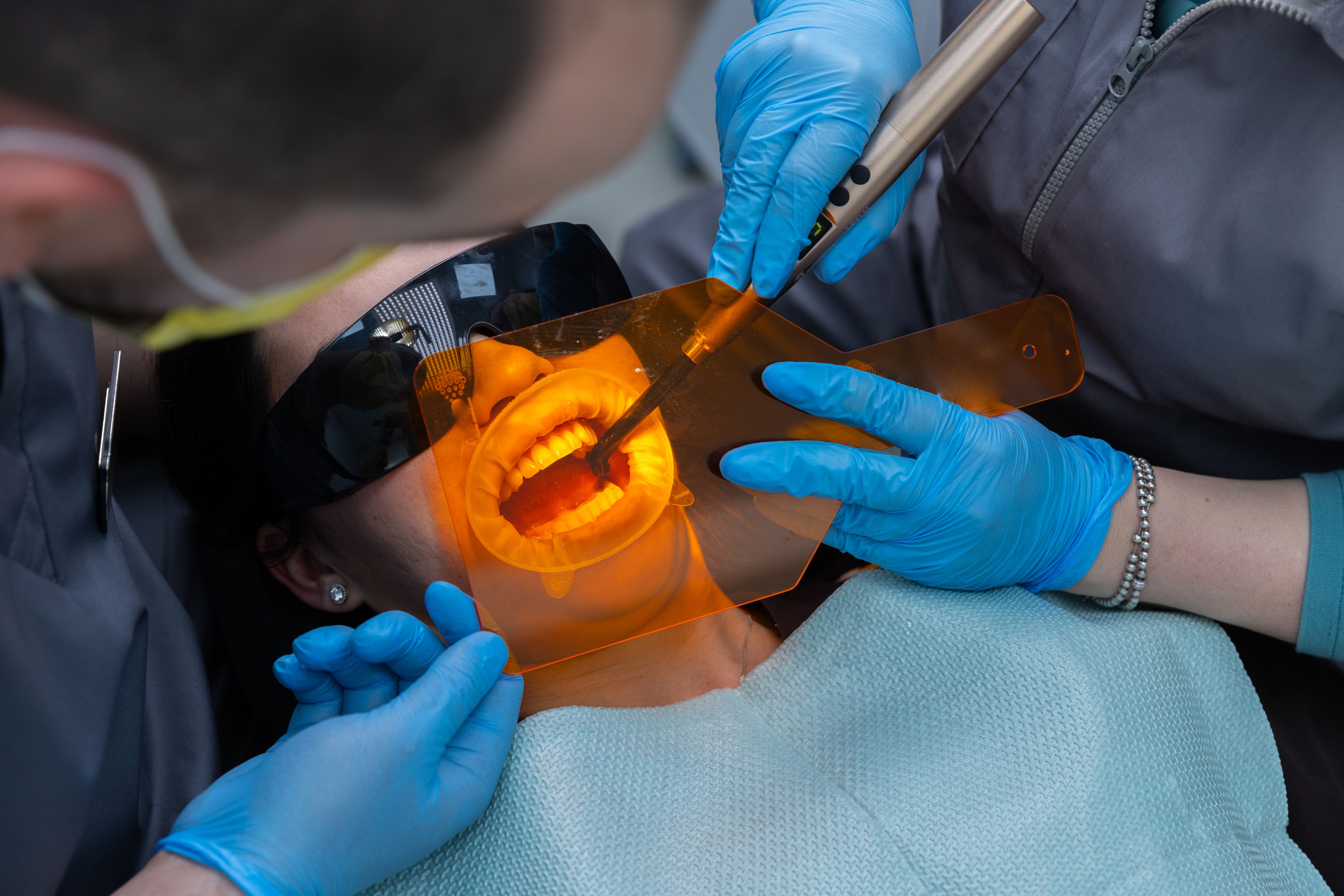 laser treatment