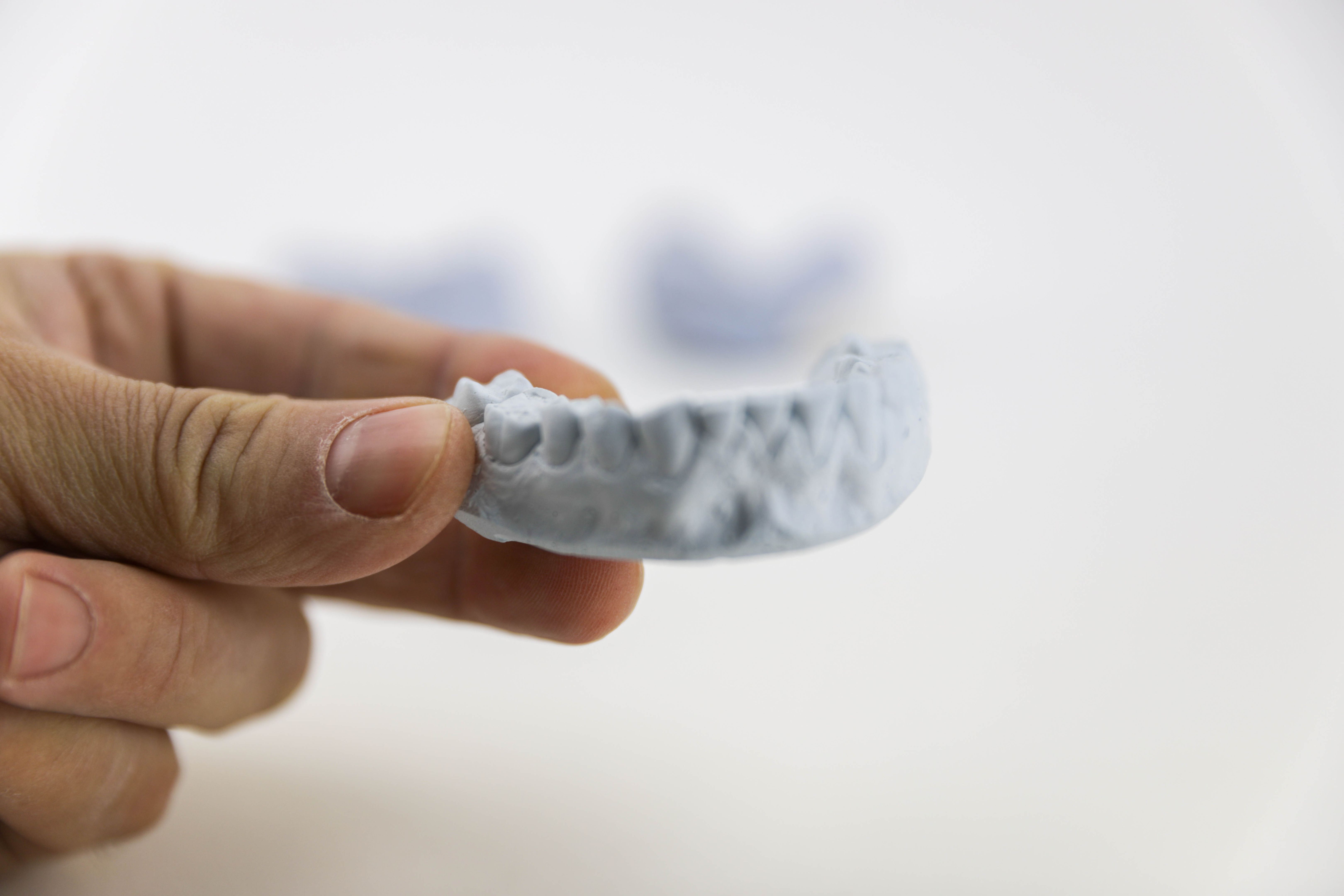 3D dental print
