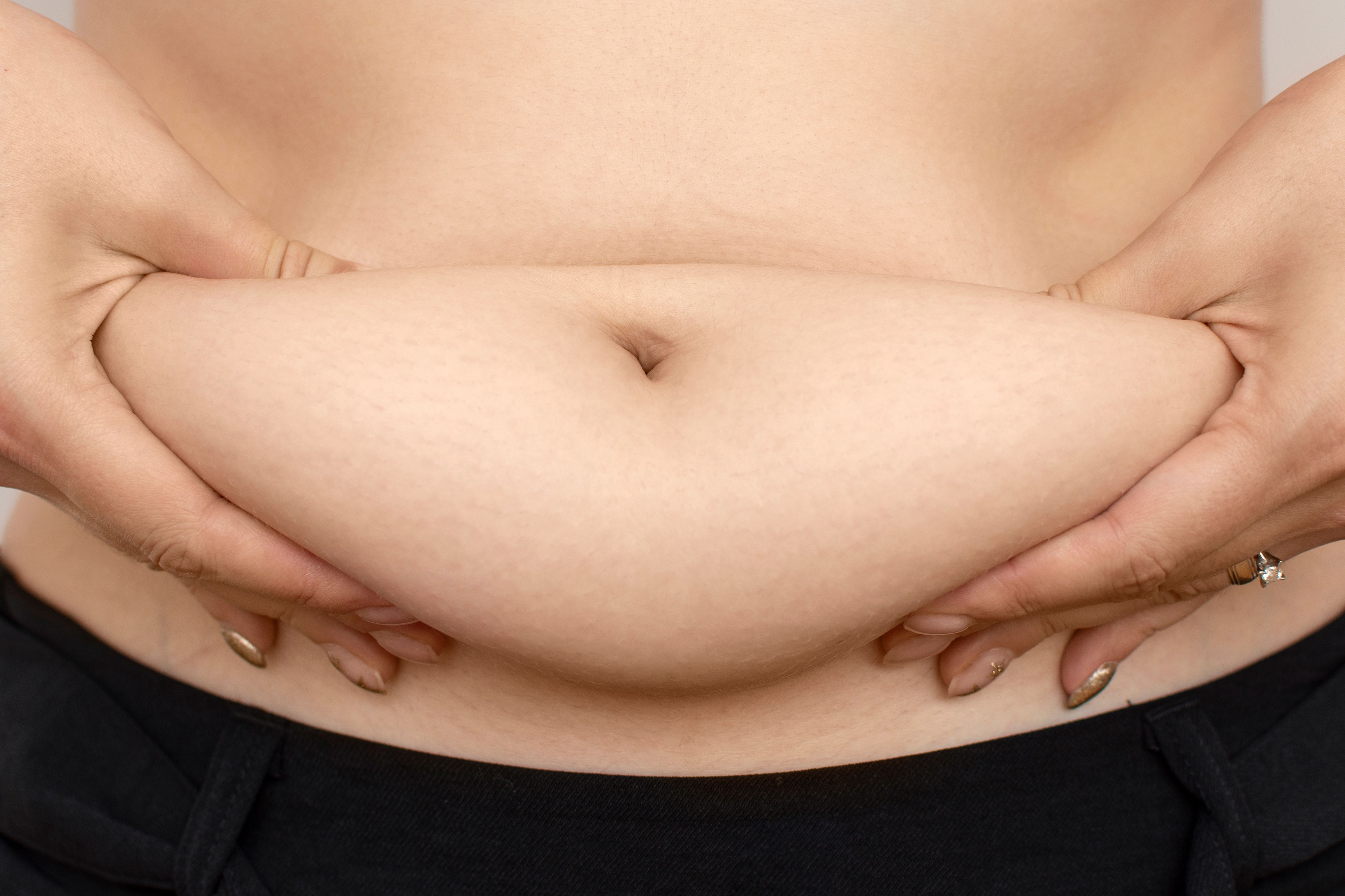 Fat woman with obesity pinching her fat tummy. Girl with overweight. Fat woman with obesity pinching her fat tummy. Girl with overweight.