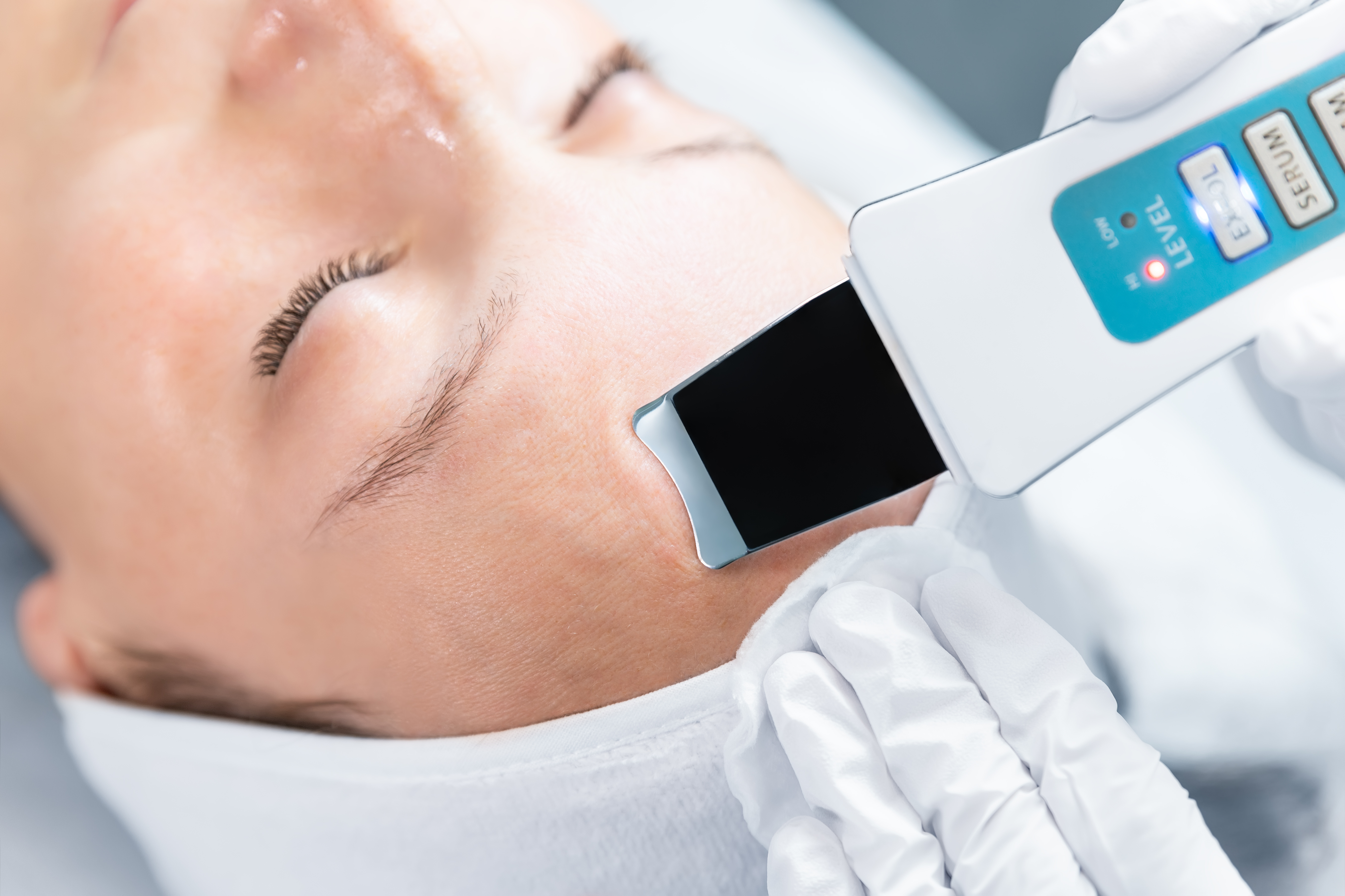 Beneficii Peeling Cavitational Giana Glow Sector 1 București Aviatorilor Arc de Triumf