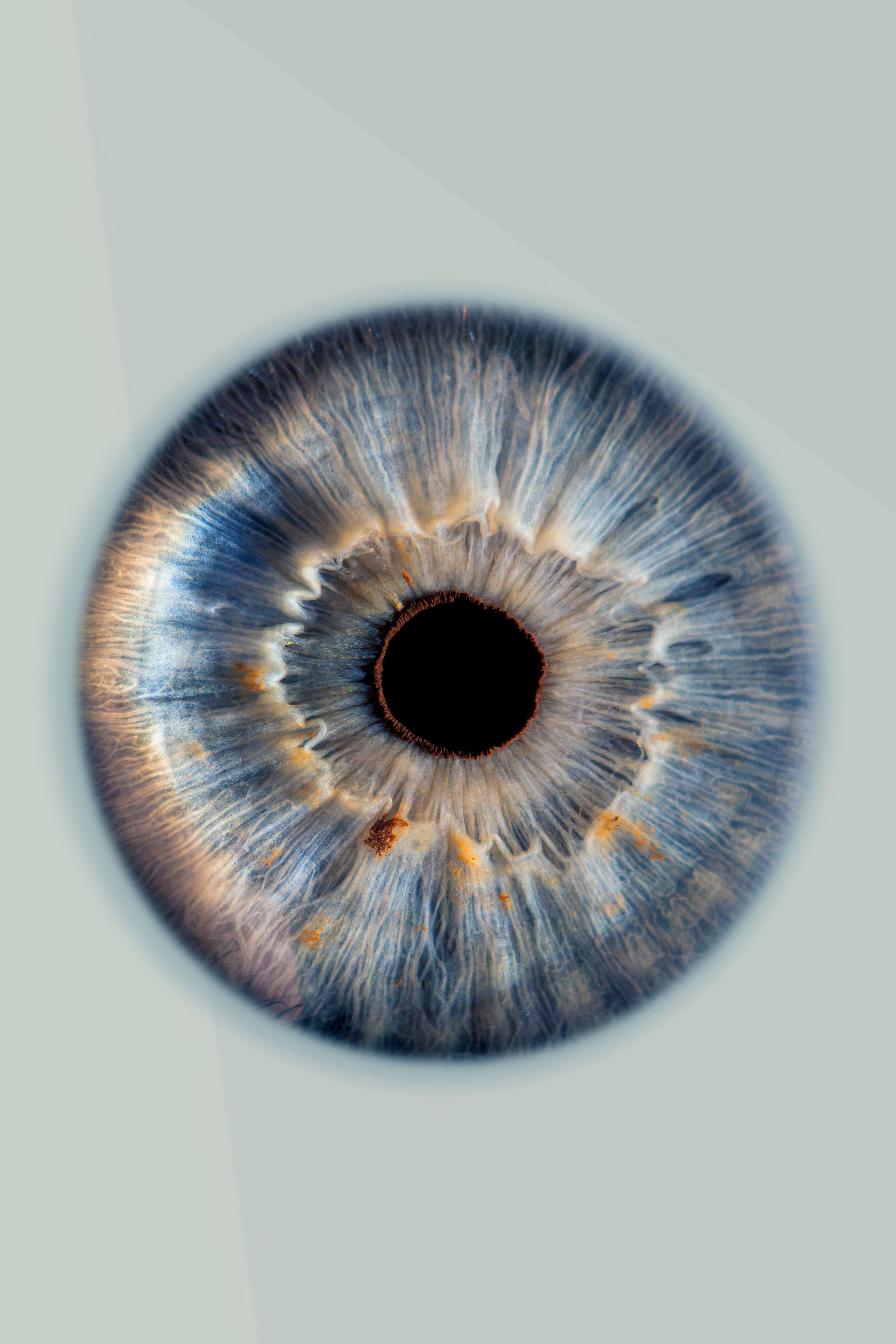 eye iris