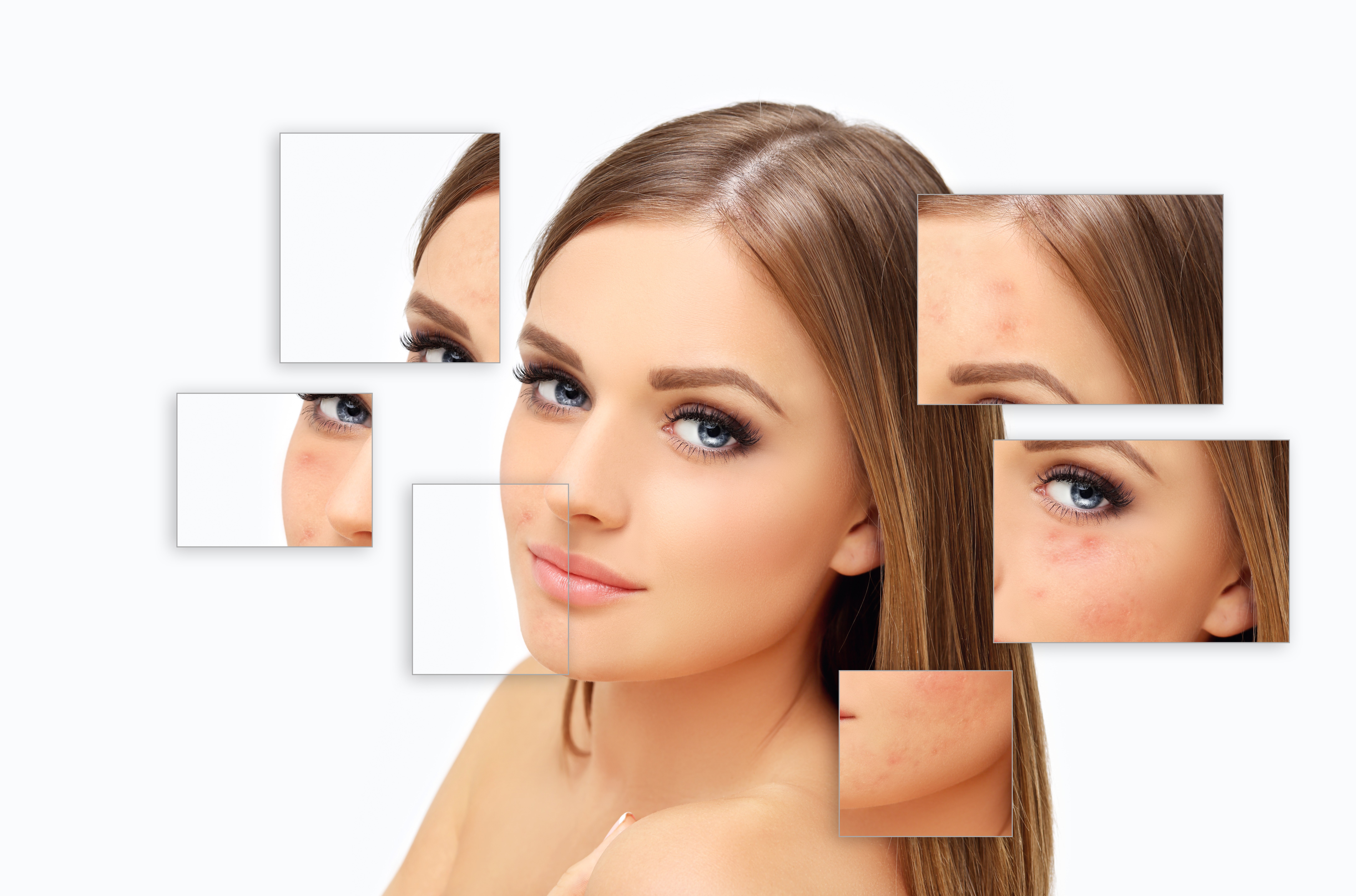 Cicatrici Post-Acneice Giana Glow București Sector 1 Aviatorilor Arc de Triumf