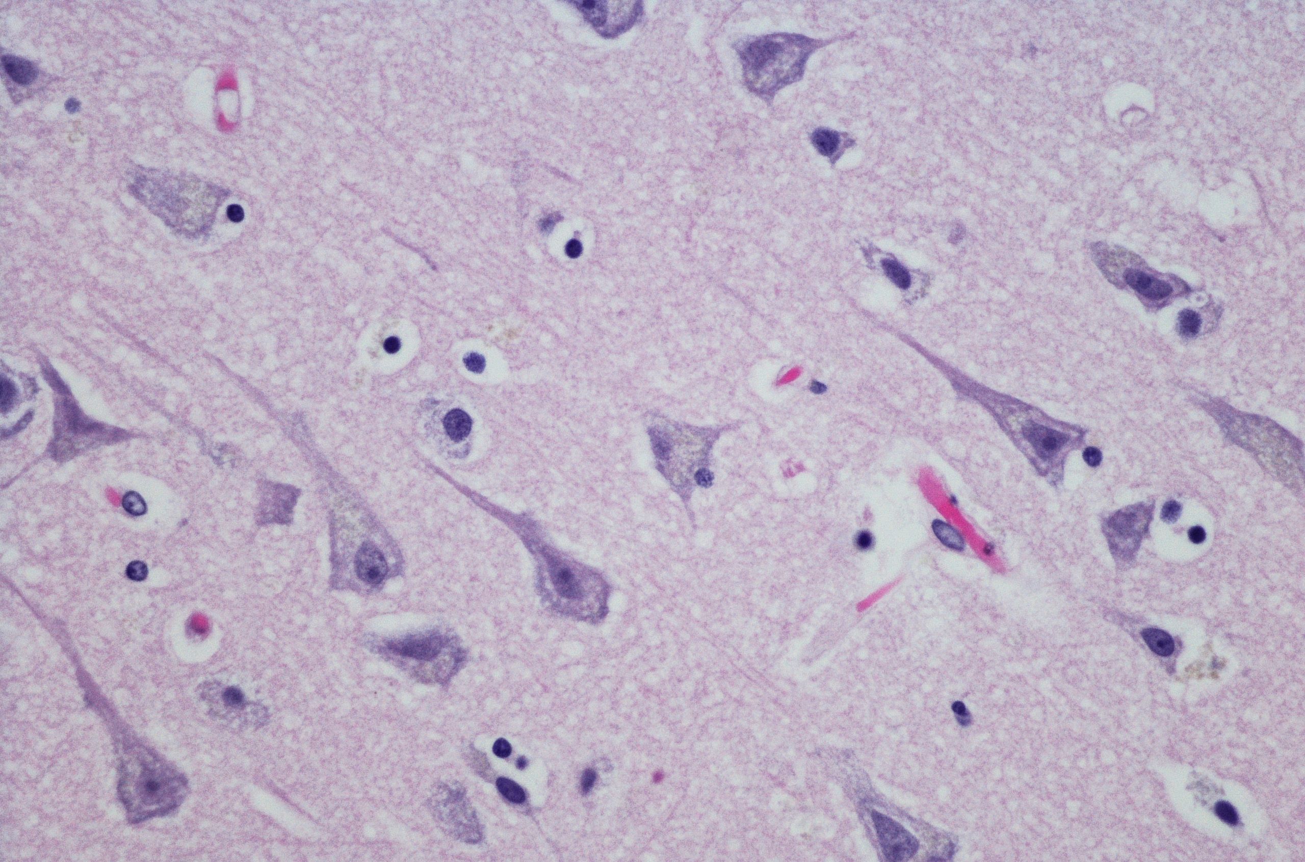 glial cells