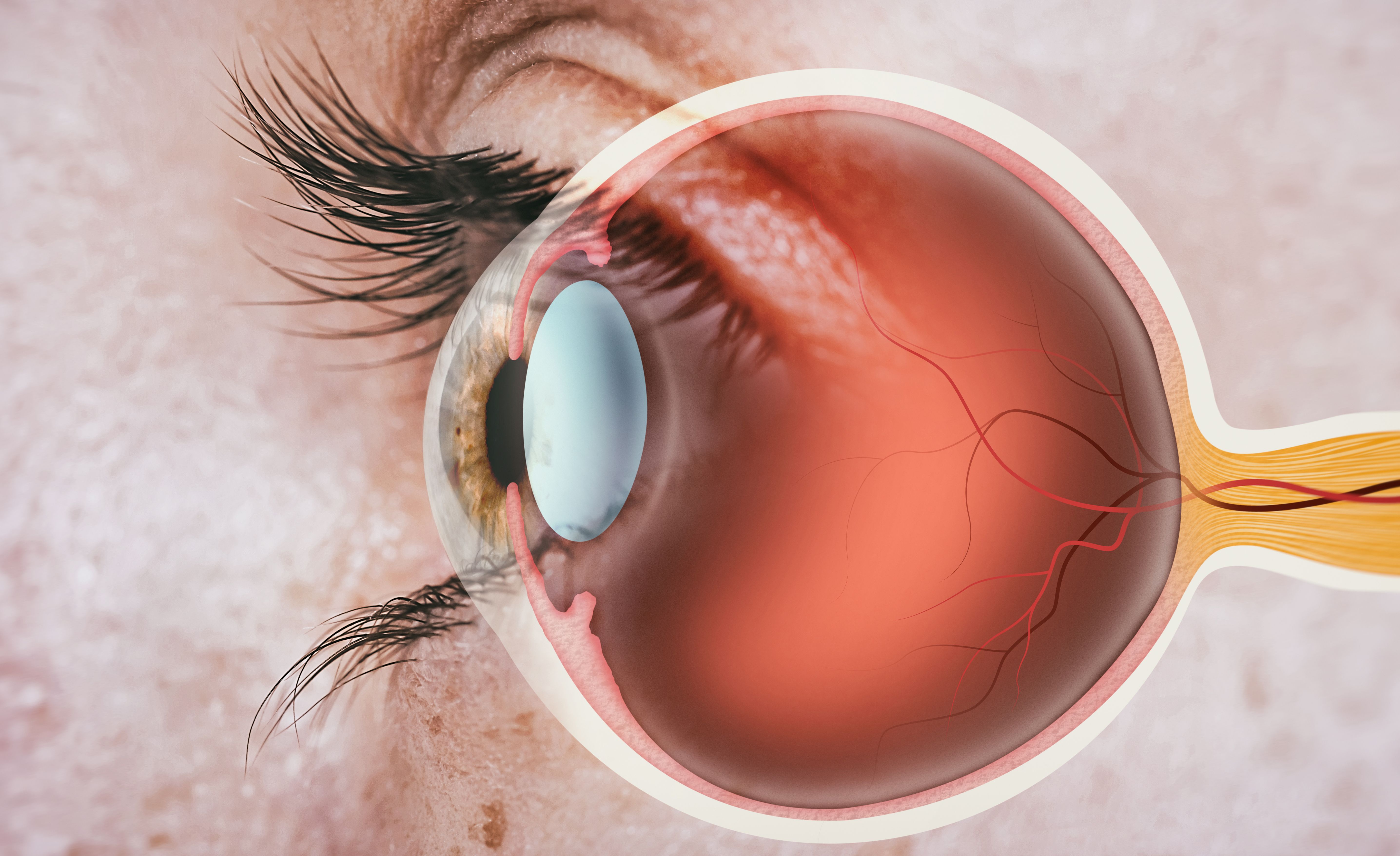 eye alignment