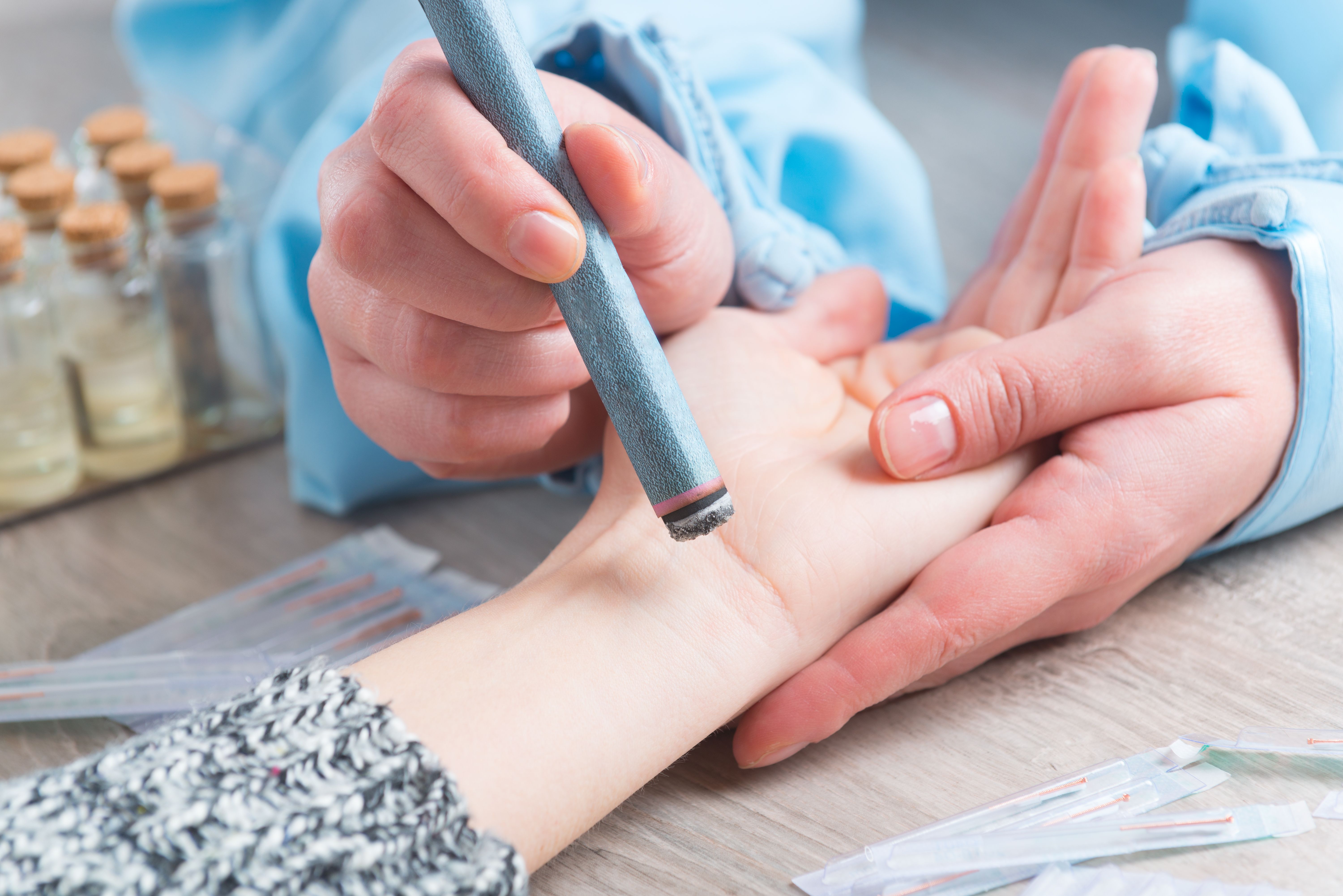 moxibustion practice