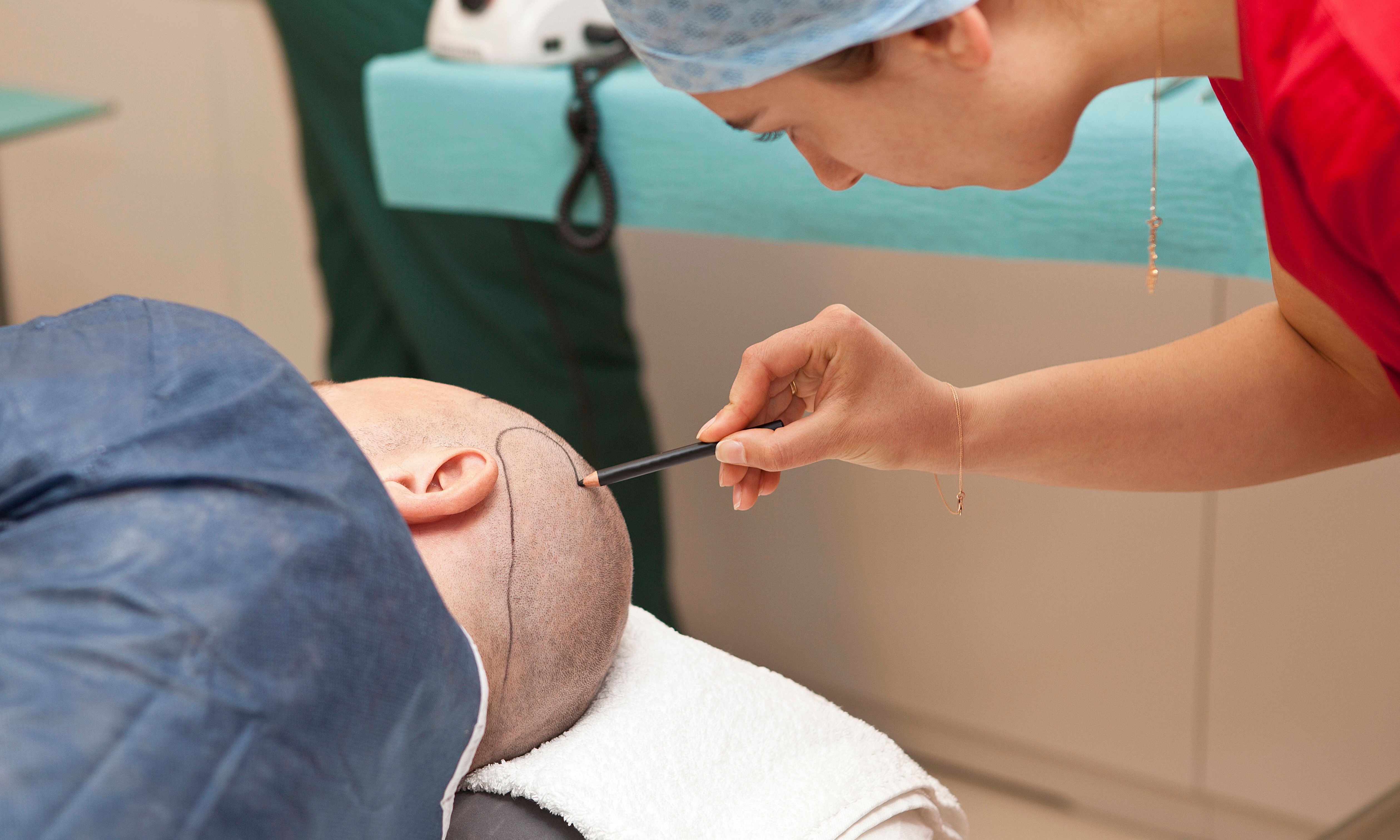 hair transplant procedure