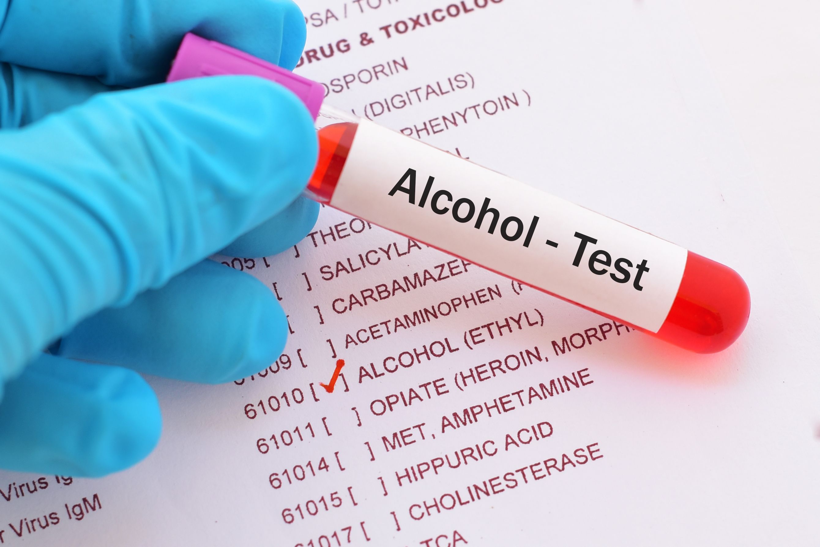 drug alcohol testing