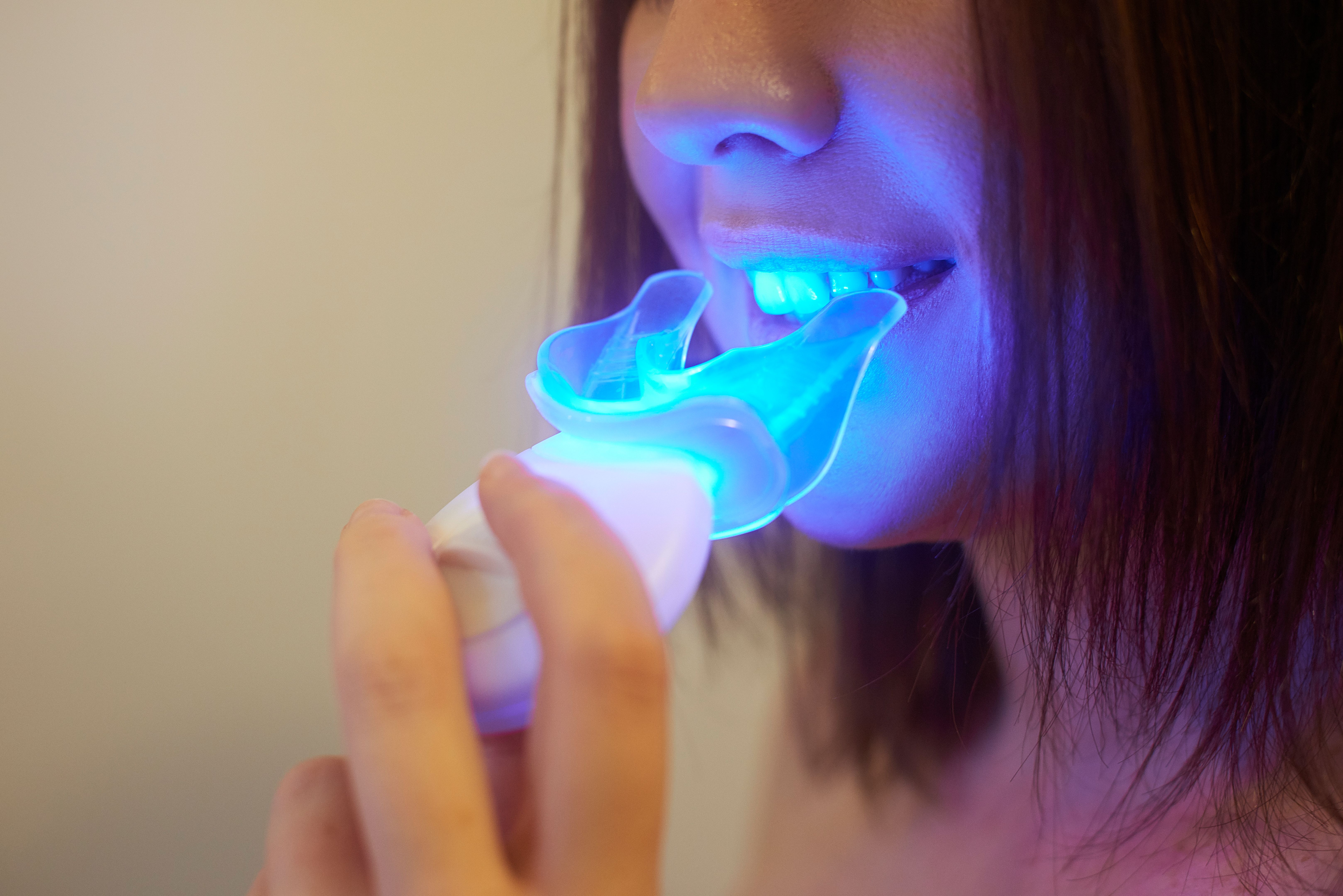 home teeth whitening