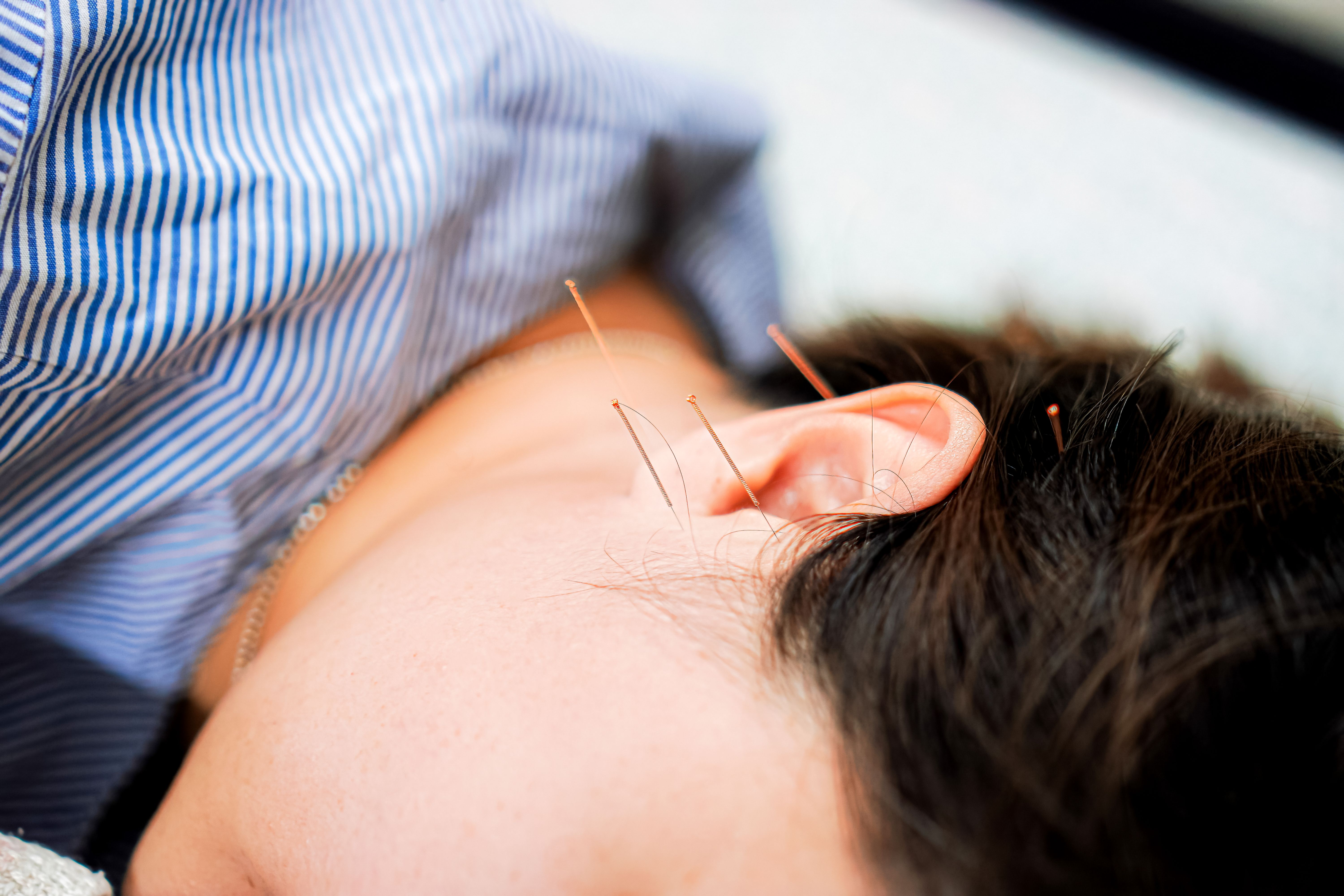 acupressure technique