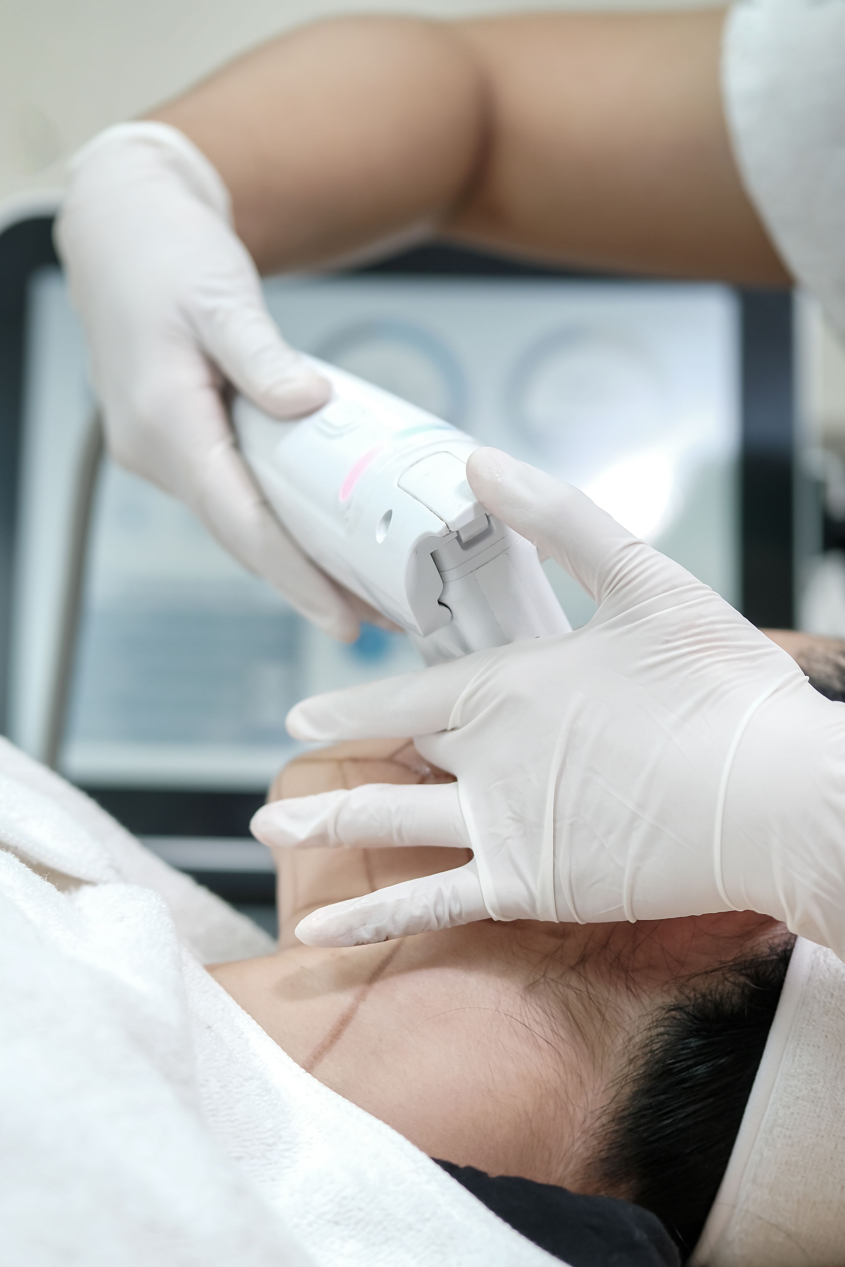 Close up of woman receiving HIFU therapy- high intensity focused ultrasound treatment on face. Therapist doing non-surgical cosmetic plasma lift with ultrasonic device. SMAS lifting