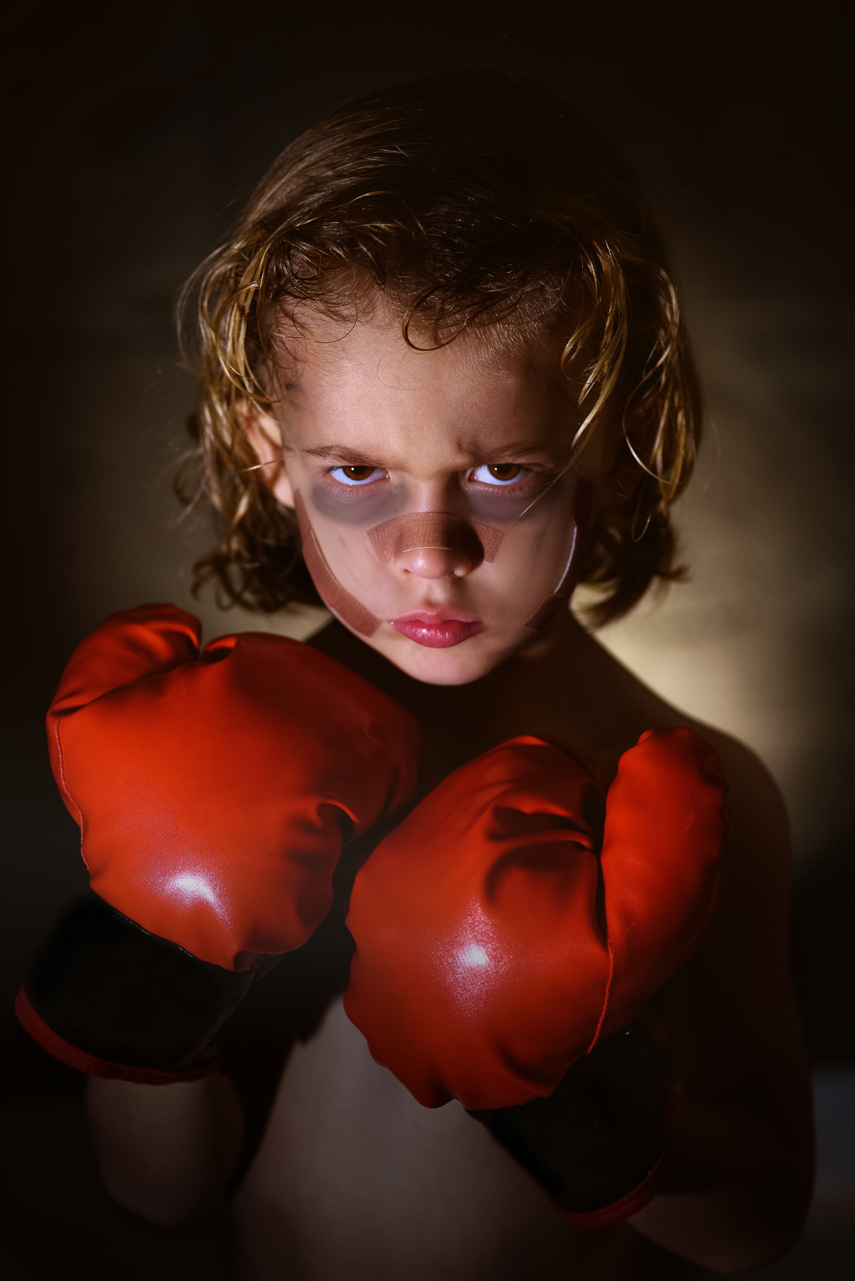 Boy with bruises in boxing gloves