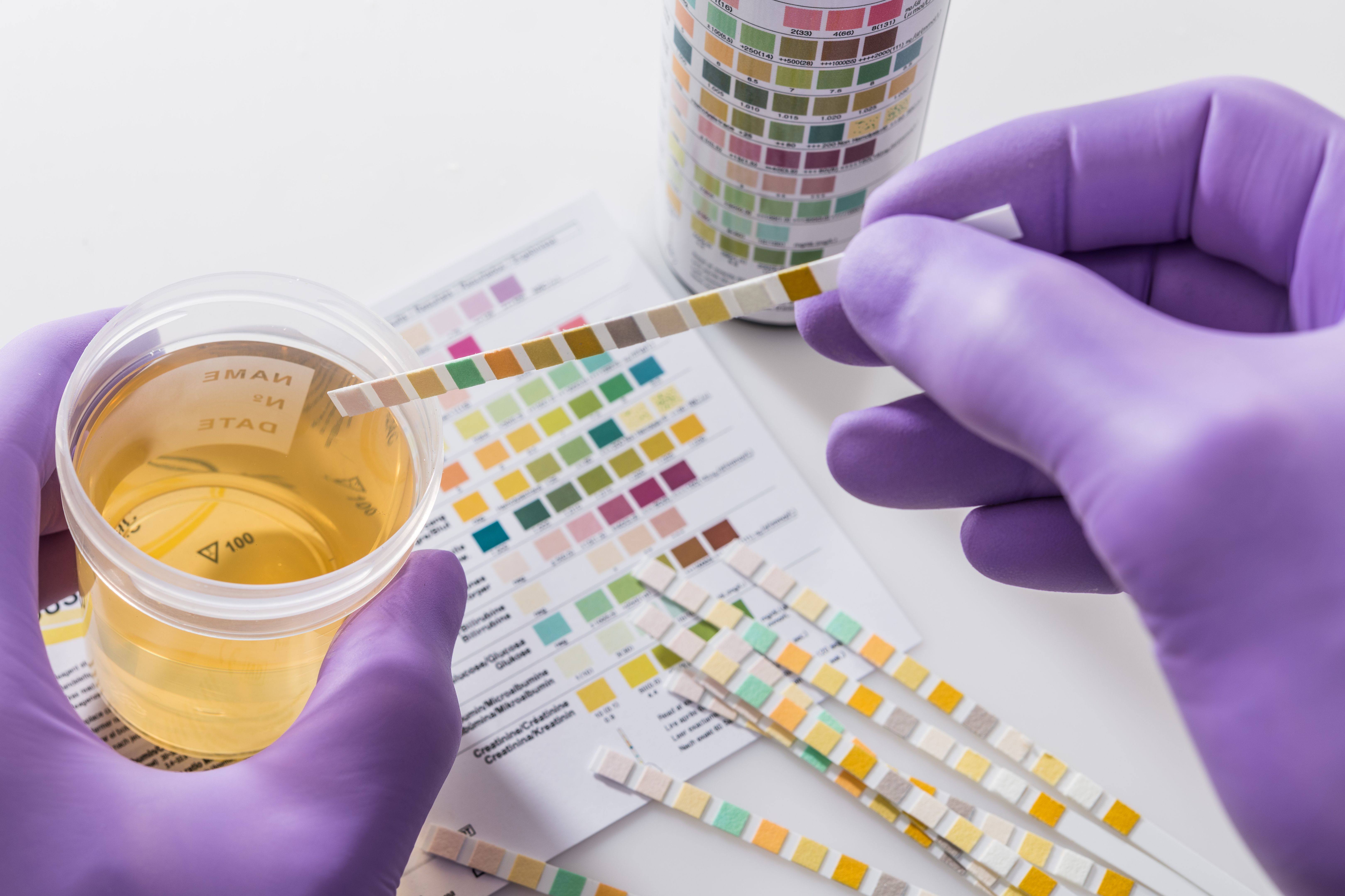 urine sample testing