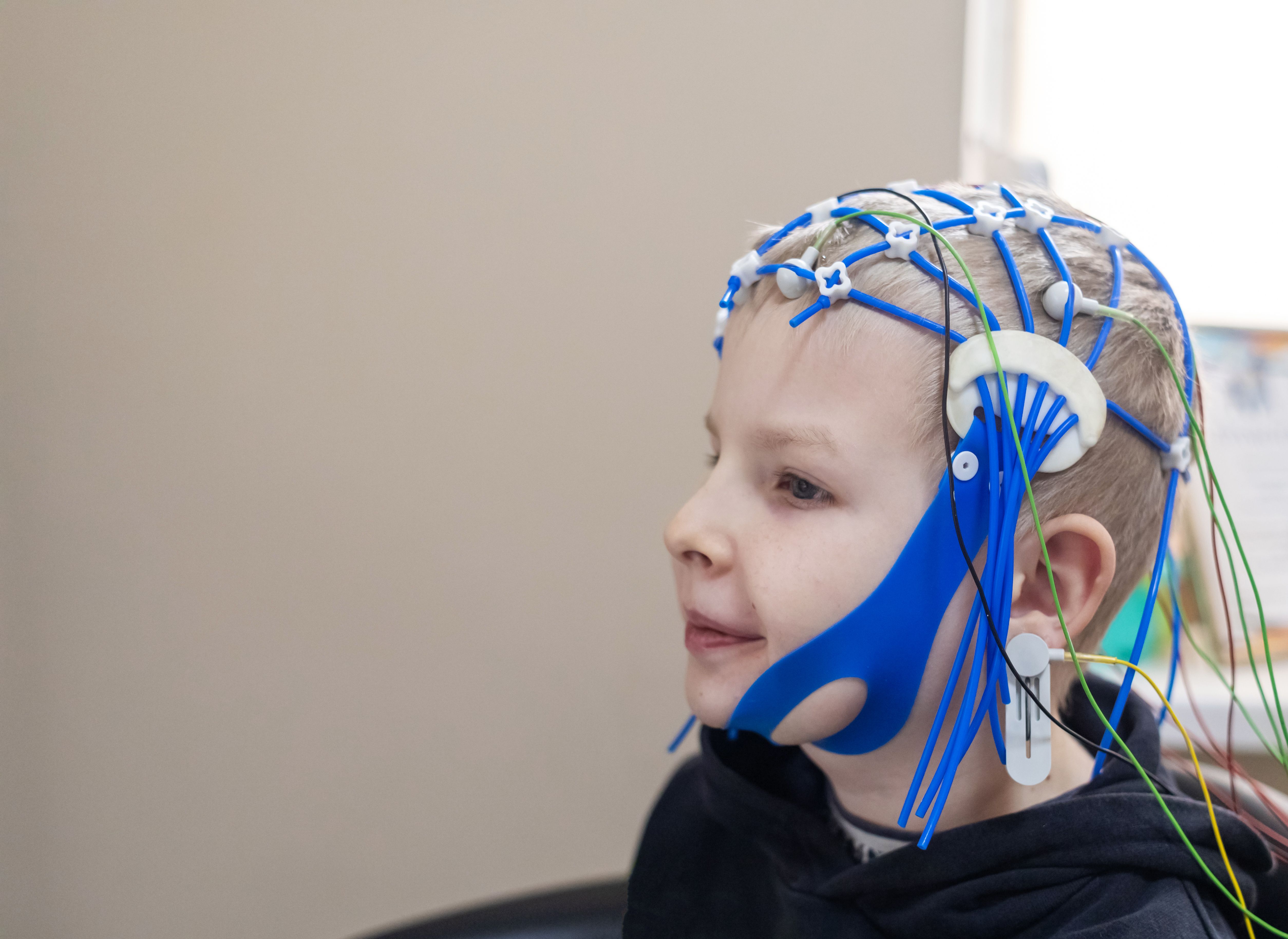 eeg monitoring