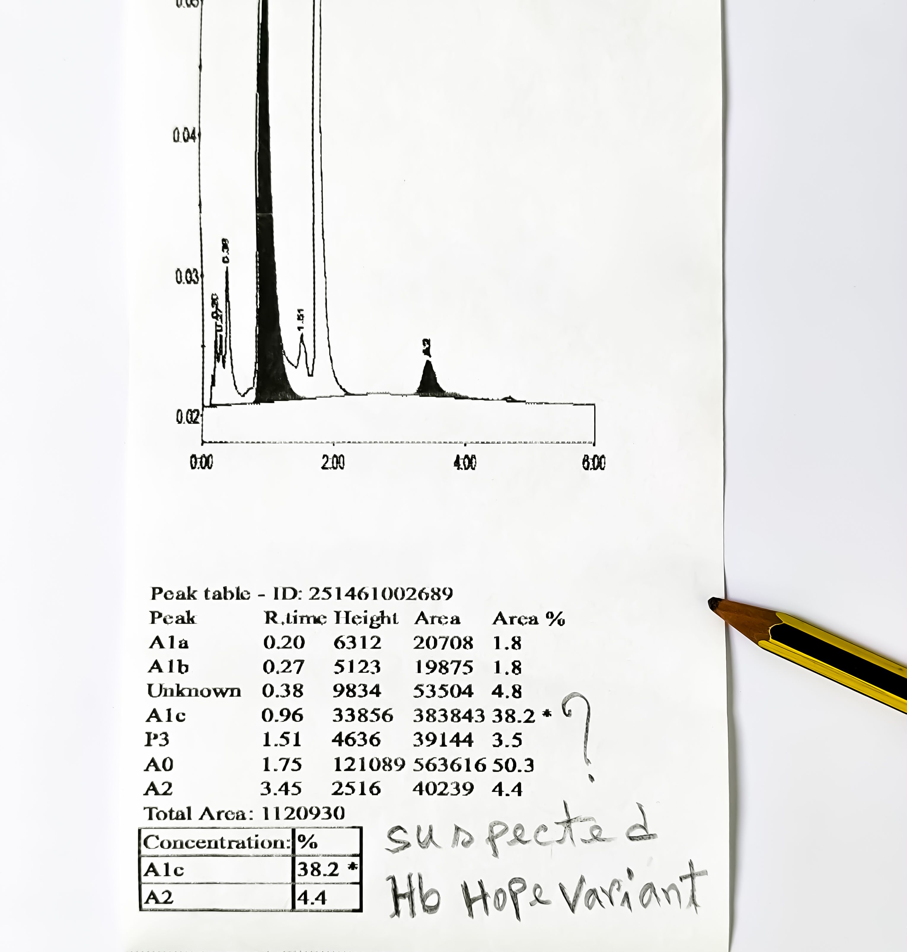 Hemoglobin Hope Variant, a rare silent variant, it can lead to elevated HbA1c levels on certain methods, especially HPLC, due to interference with the detection of HbA1c.
