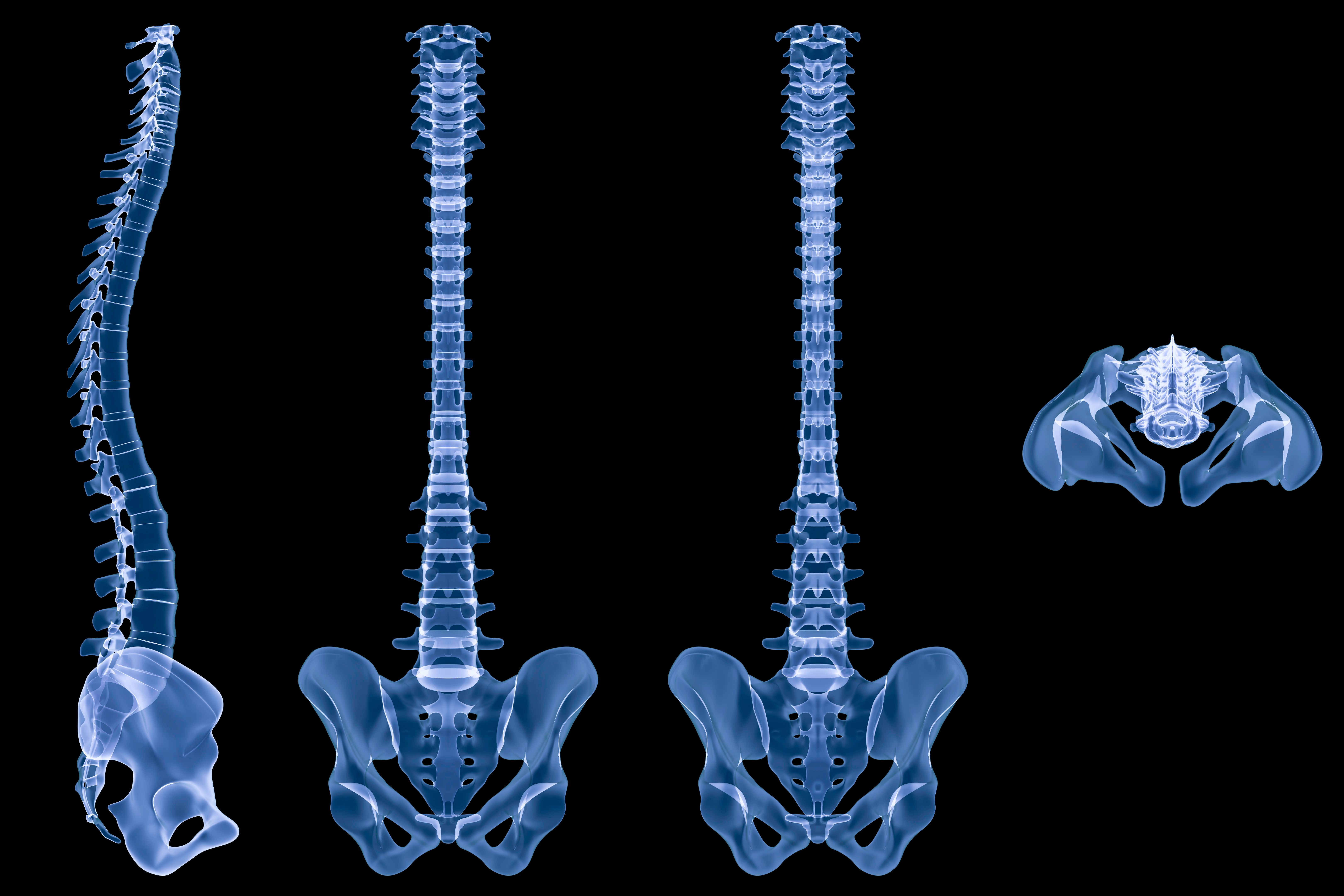 X-ray human spine-4 views