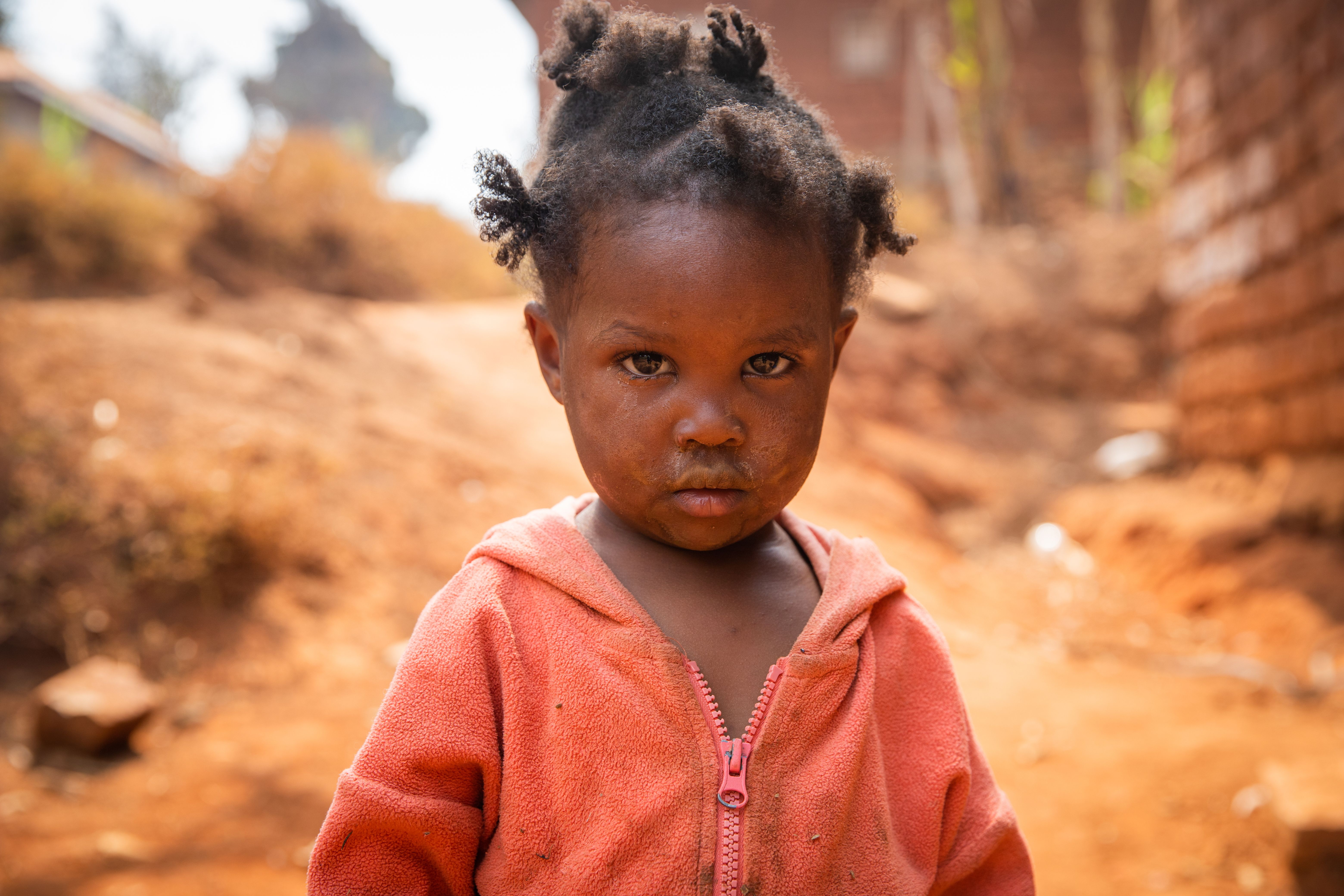 Poor little girl wearing dirty clothes in an African village, poverty and crisis concept.