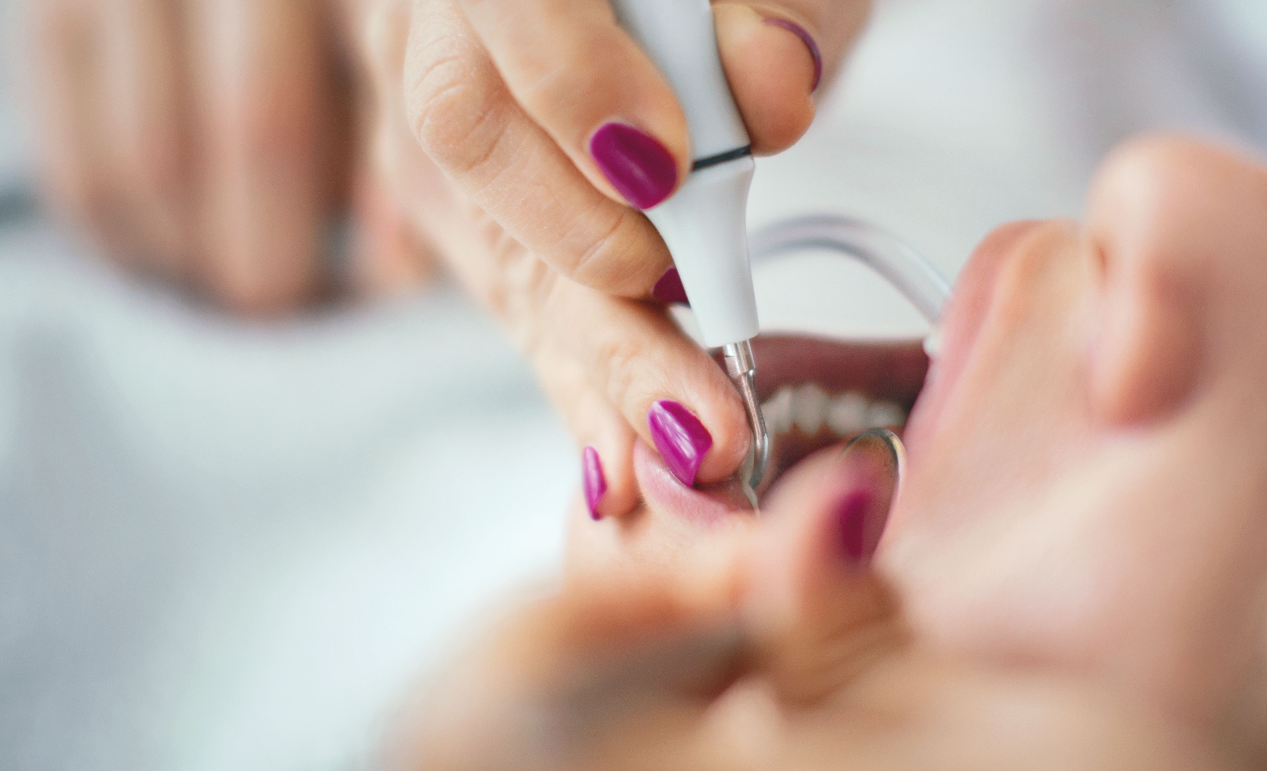 preventive dental care