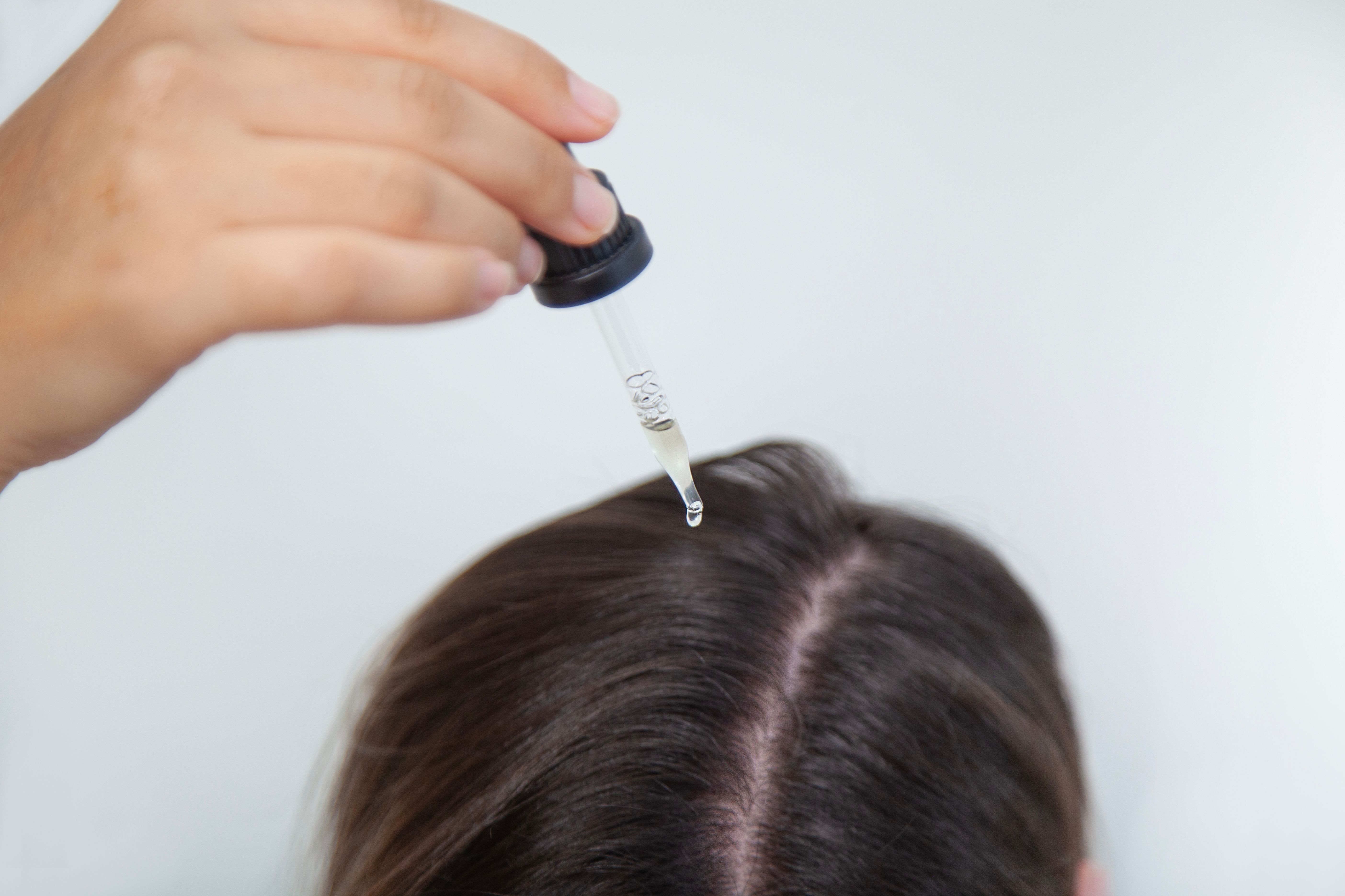 Minoxidil hair loss treatment leicester