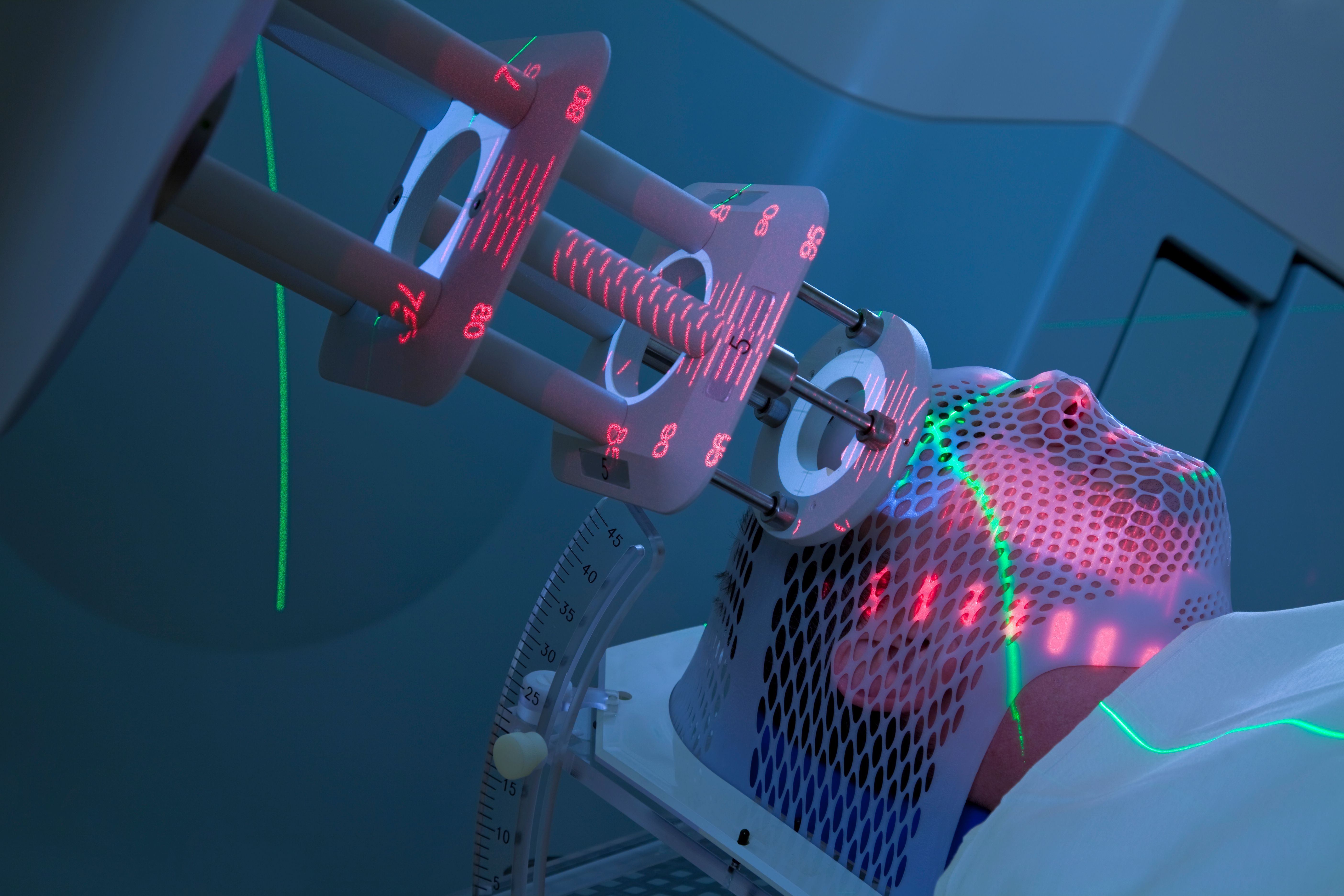 industrial laser equipment