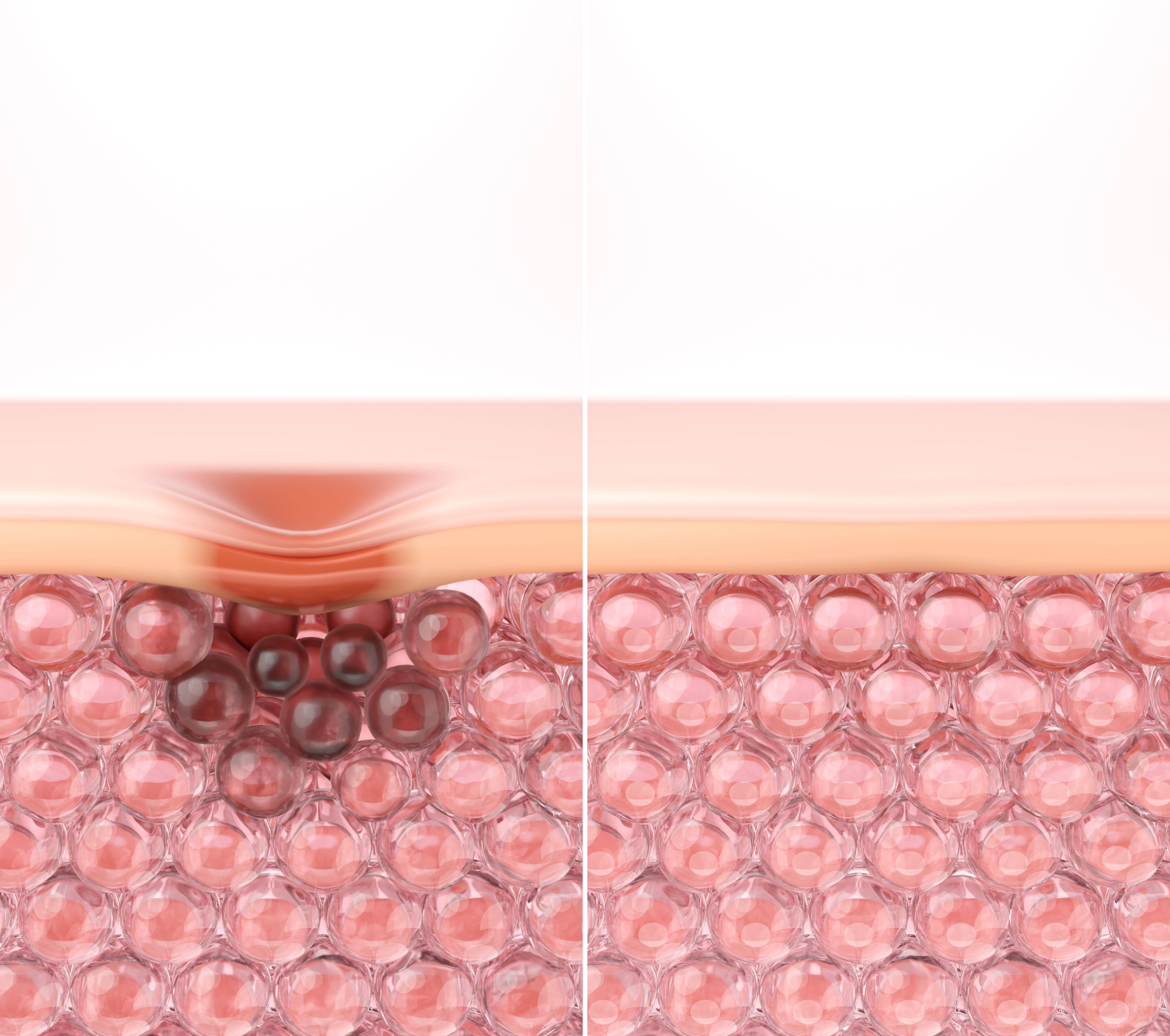 PDRN Exosome for Acne Scar and Dark Spot Repair 3D Comparison