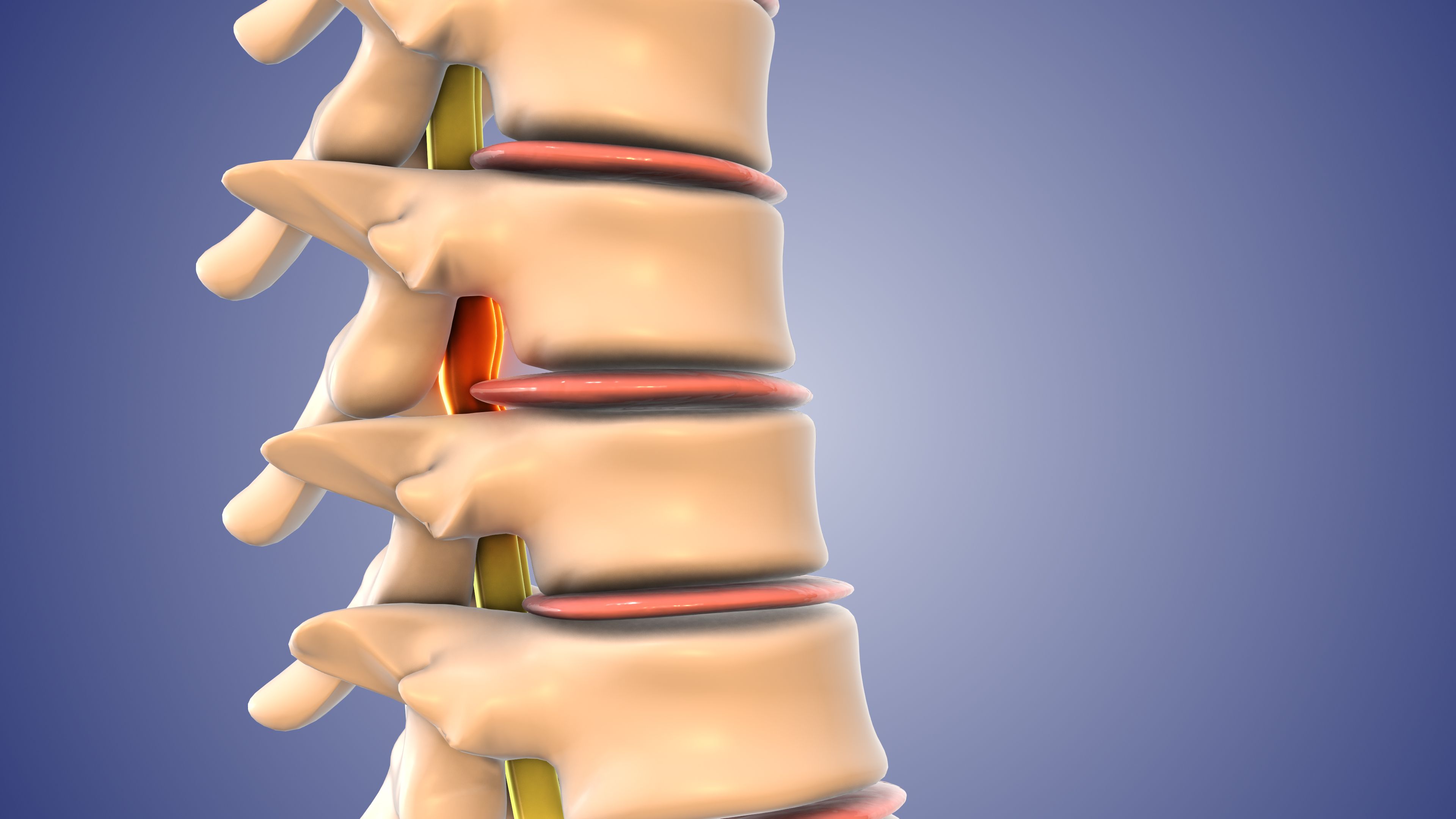 spinal decompression