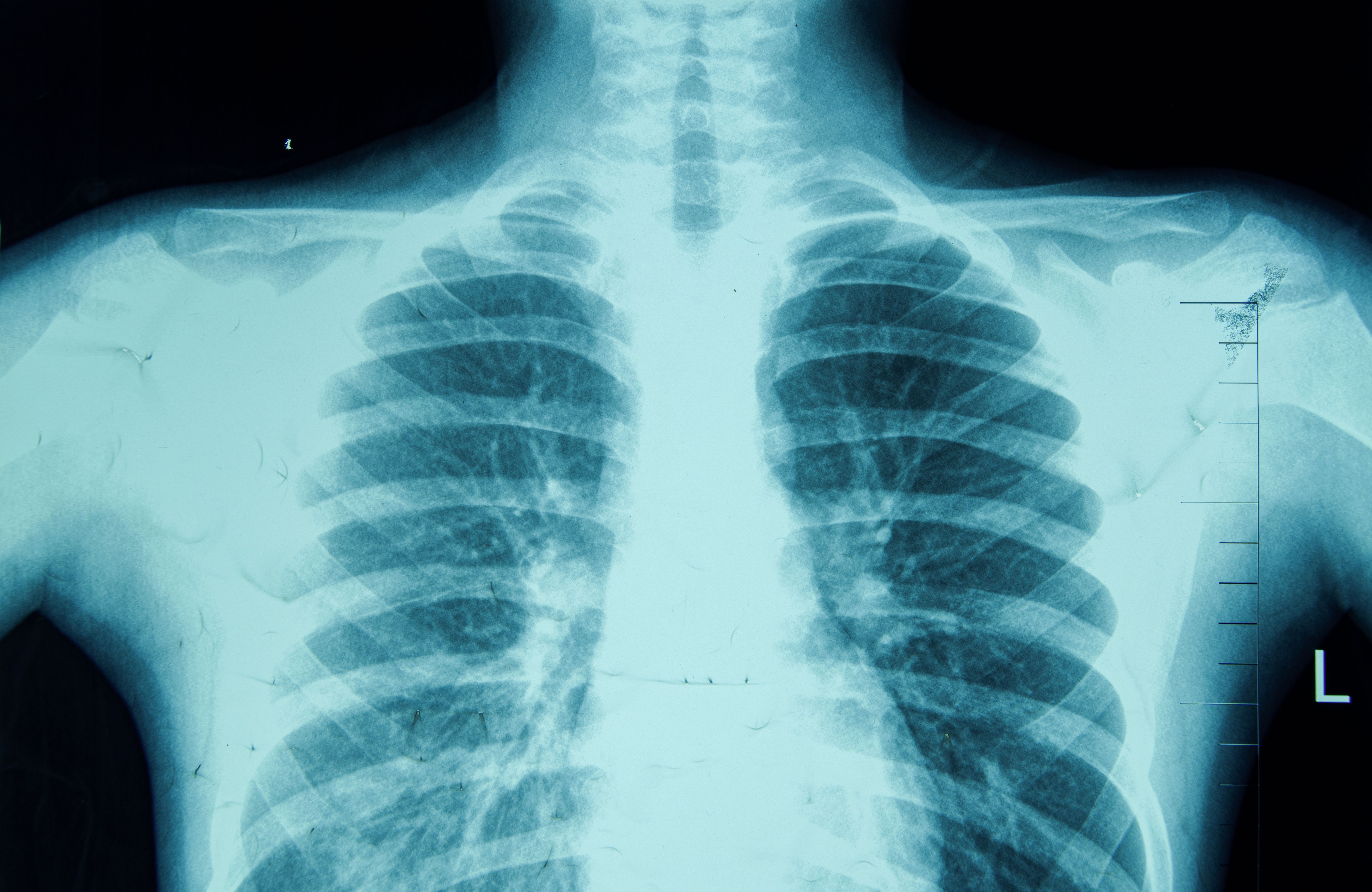 medical imaging