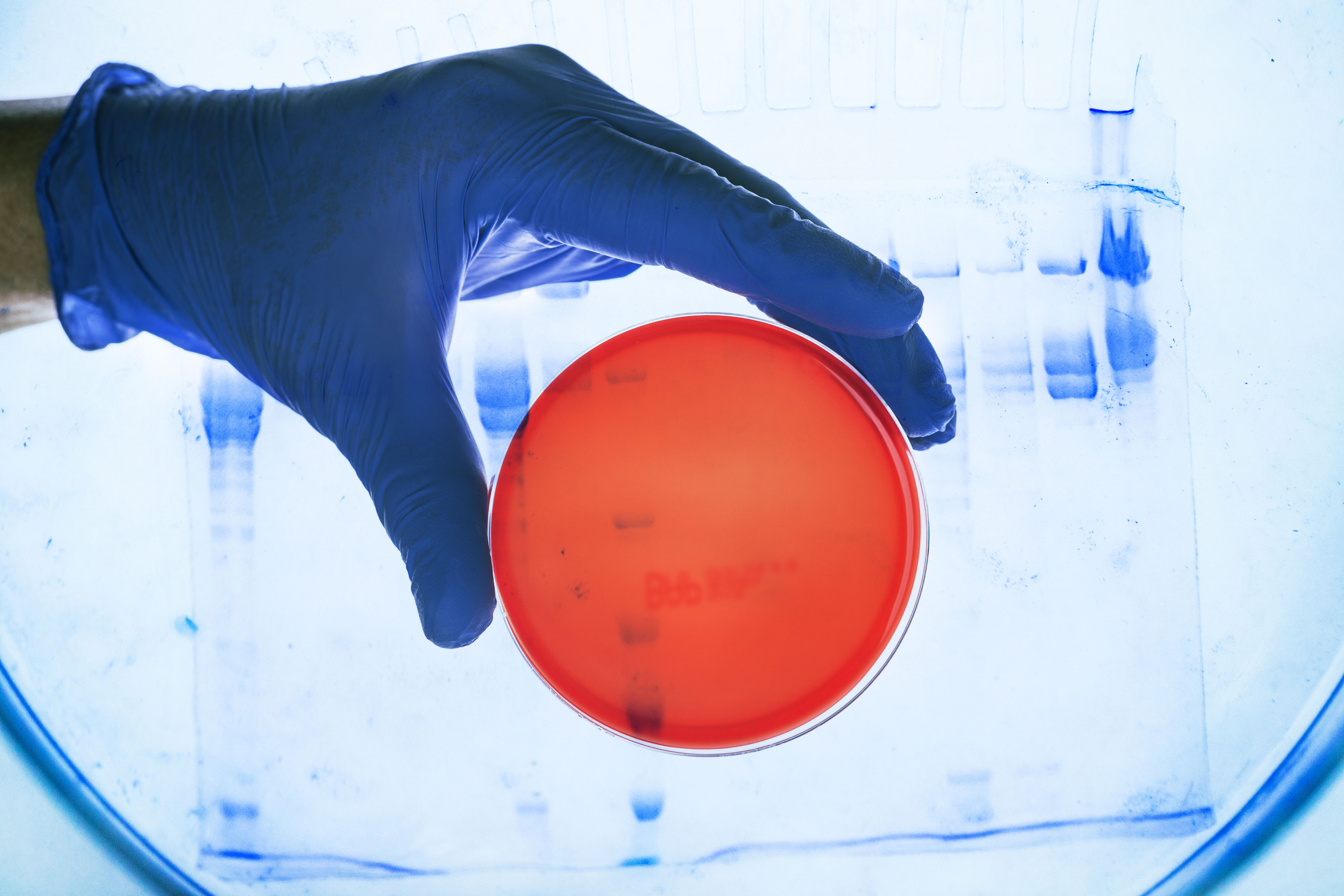 radiographic testing