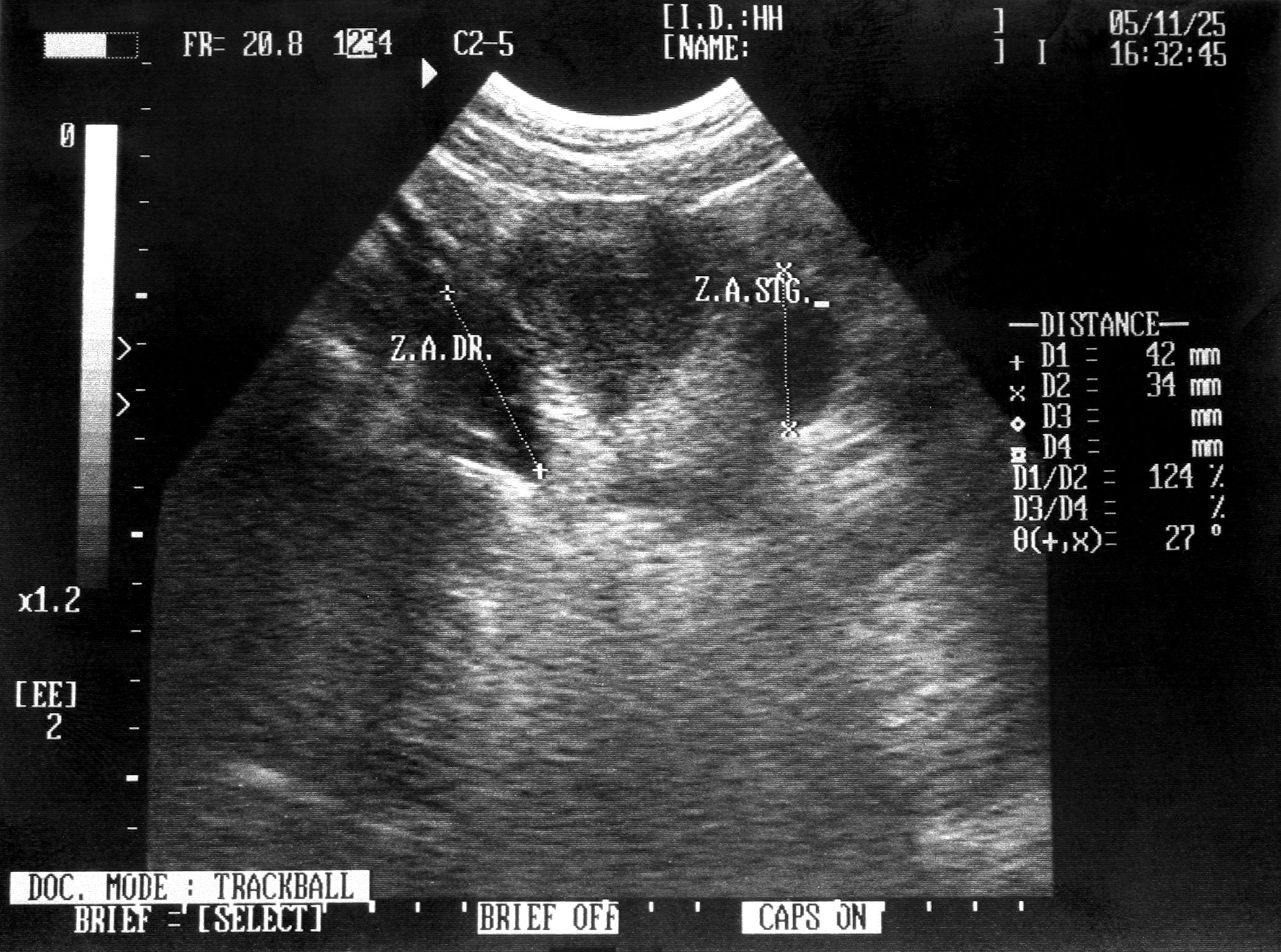 pregnant woman ultrasound